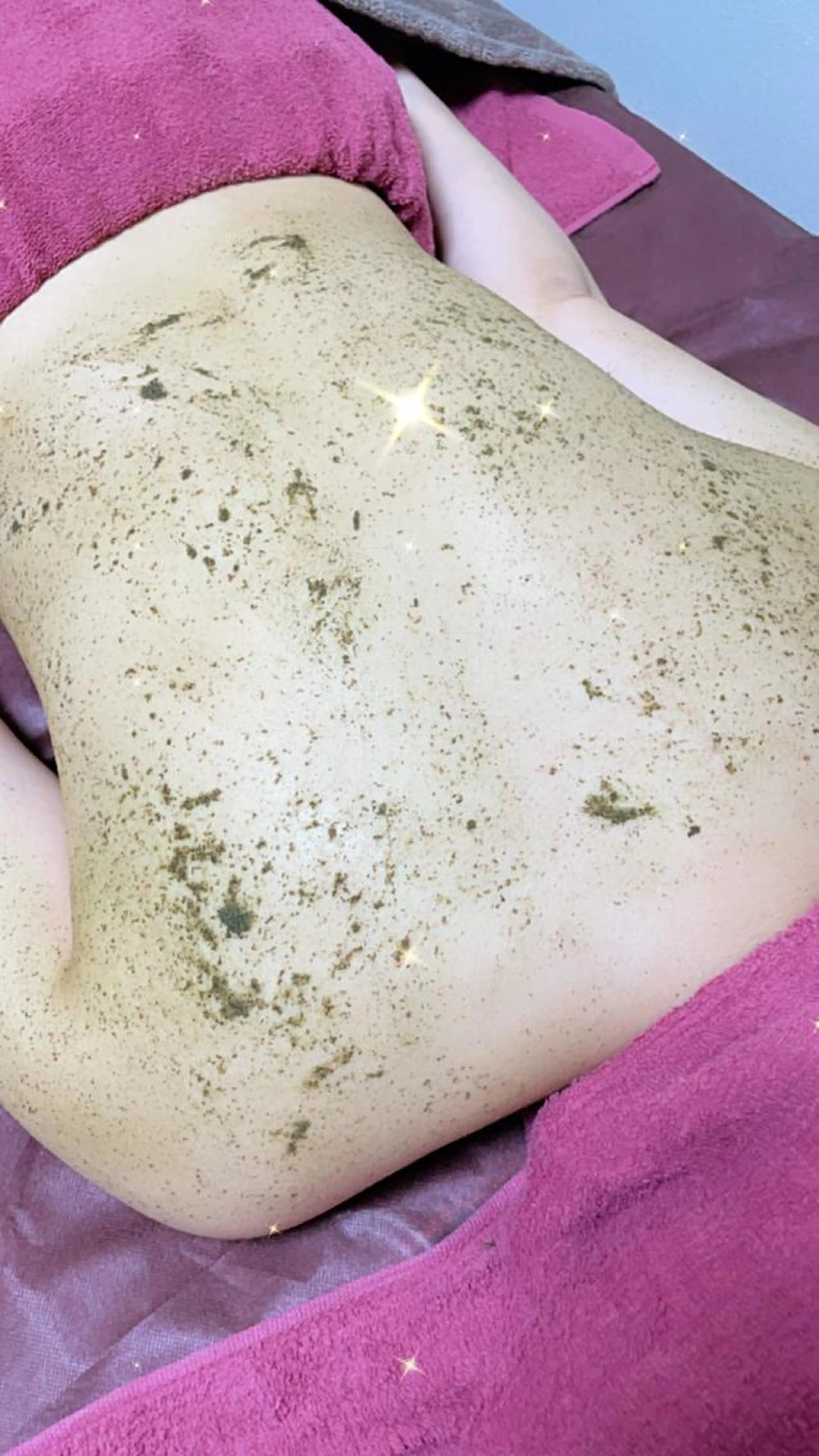 💎REVI陶肌トリートメント背面💎背中ニキビ、くすみ、色素沈着レスへ✨✨初回￥23000→15000の写真