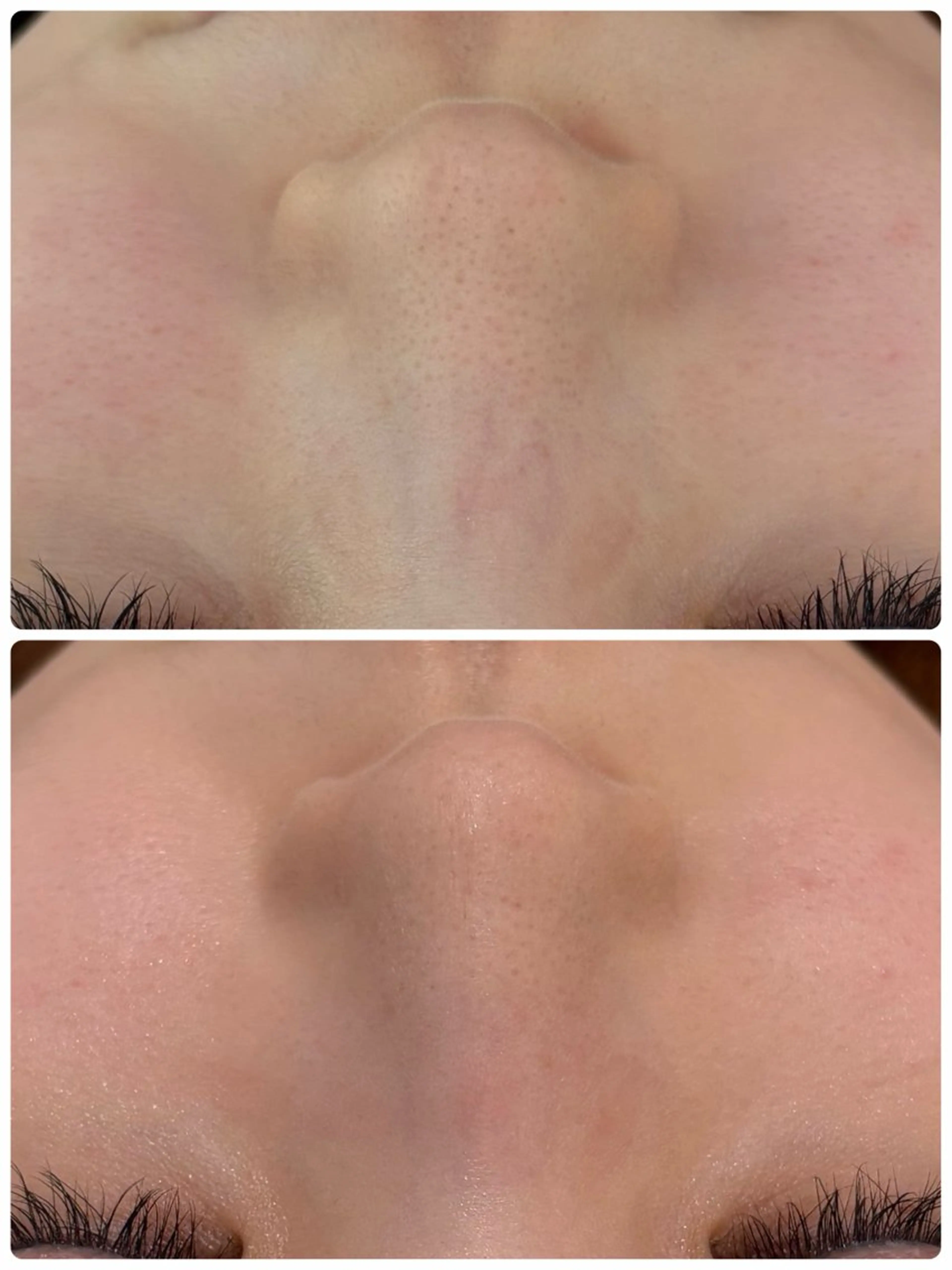 エステ ビューティサロン 笑芽のエステ・リラクイメージ