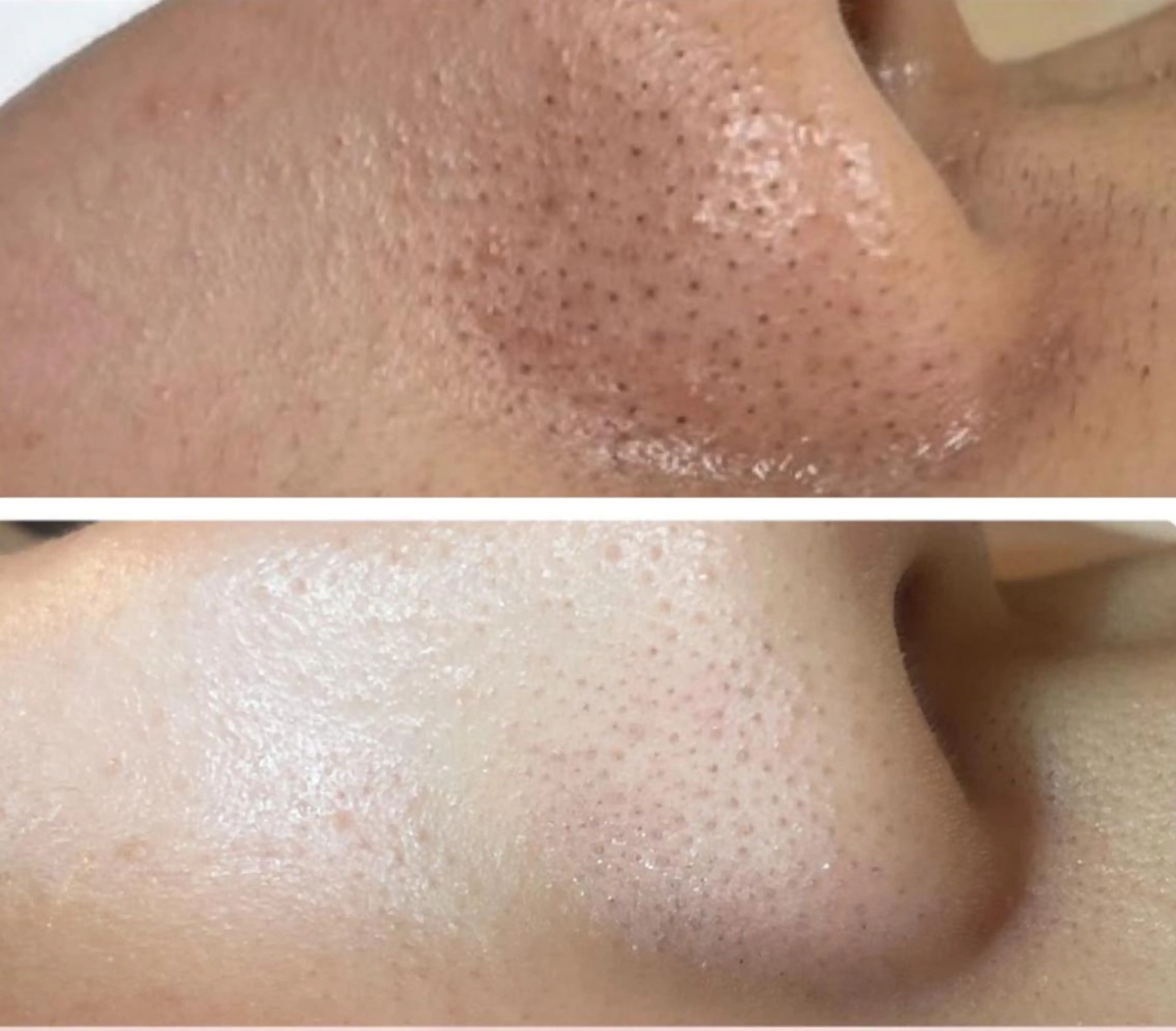 脱毛 エステティックレイ ビス秋田店　菅野のエステ・リラクイメージ