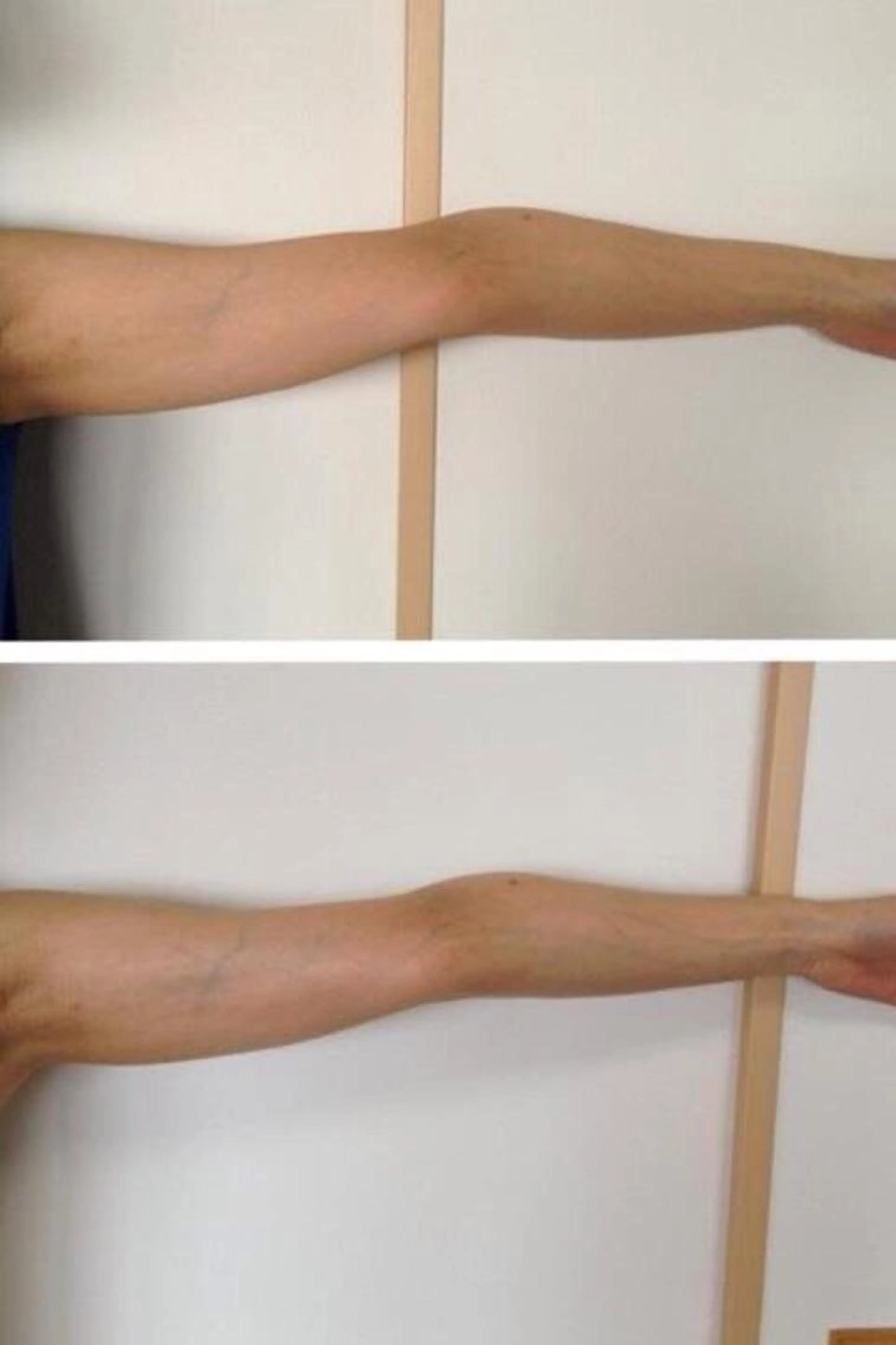 上半身強化コース【二の腕スッキリ】45分の写真