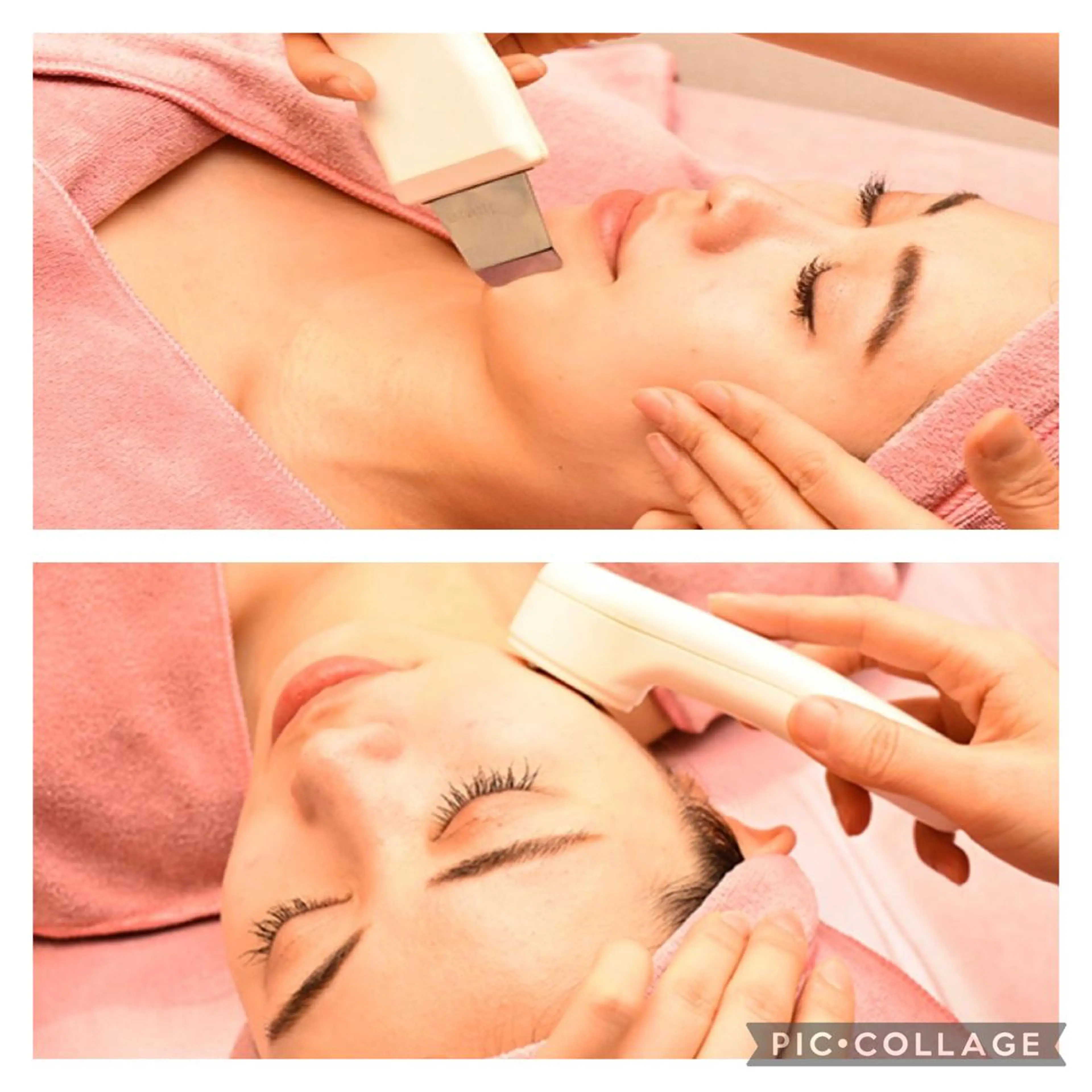 【ニキビケア】☆ニキビ肌☆つるんとした赤ちゃんのお肌へ（毛穴洗浄・首ケア付き）の写真