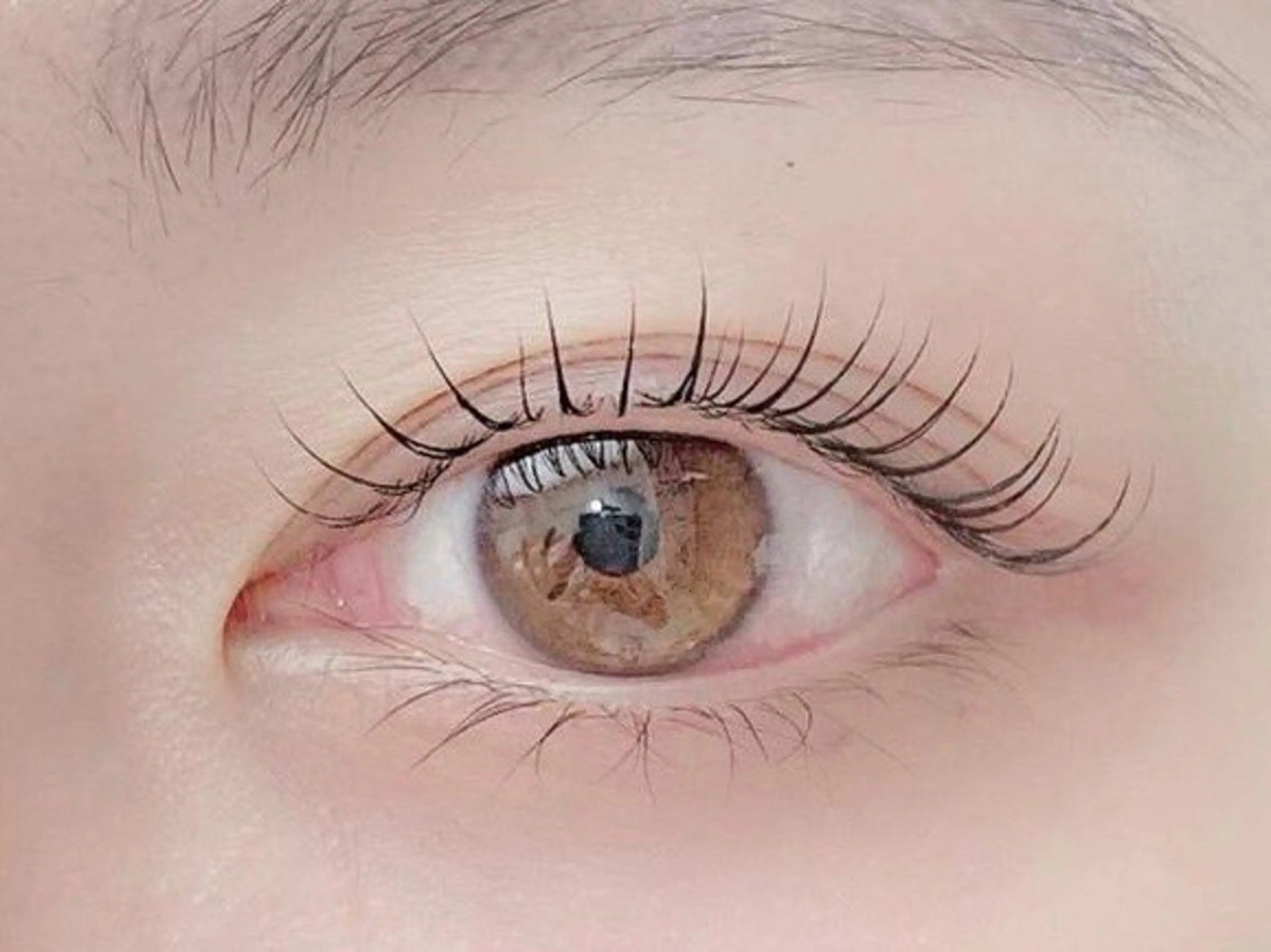 バインドロック80本の写真