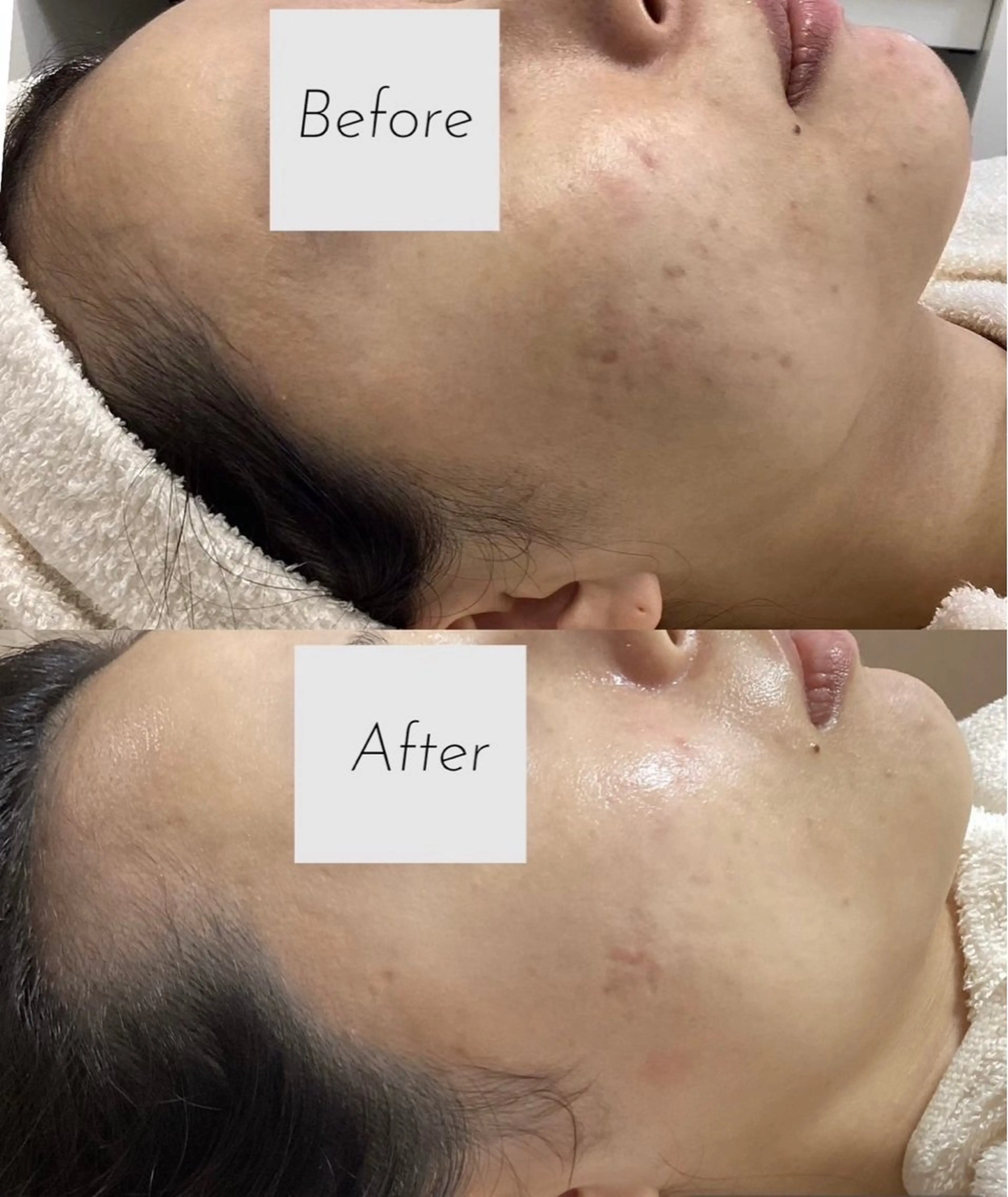 都度払い 肌質改善専門サロンのエステ・リラクイメージ