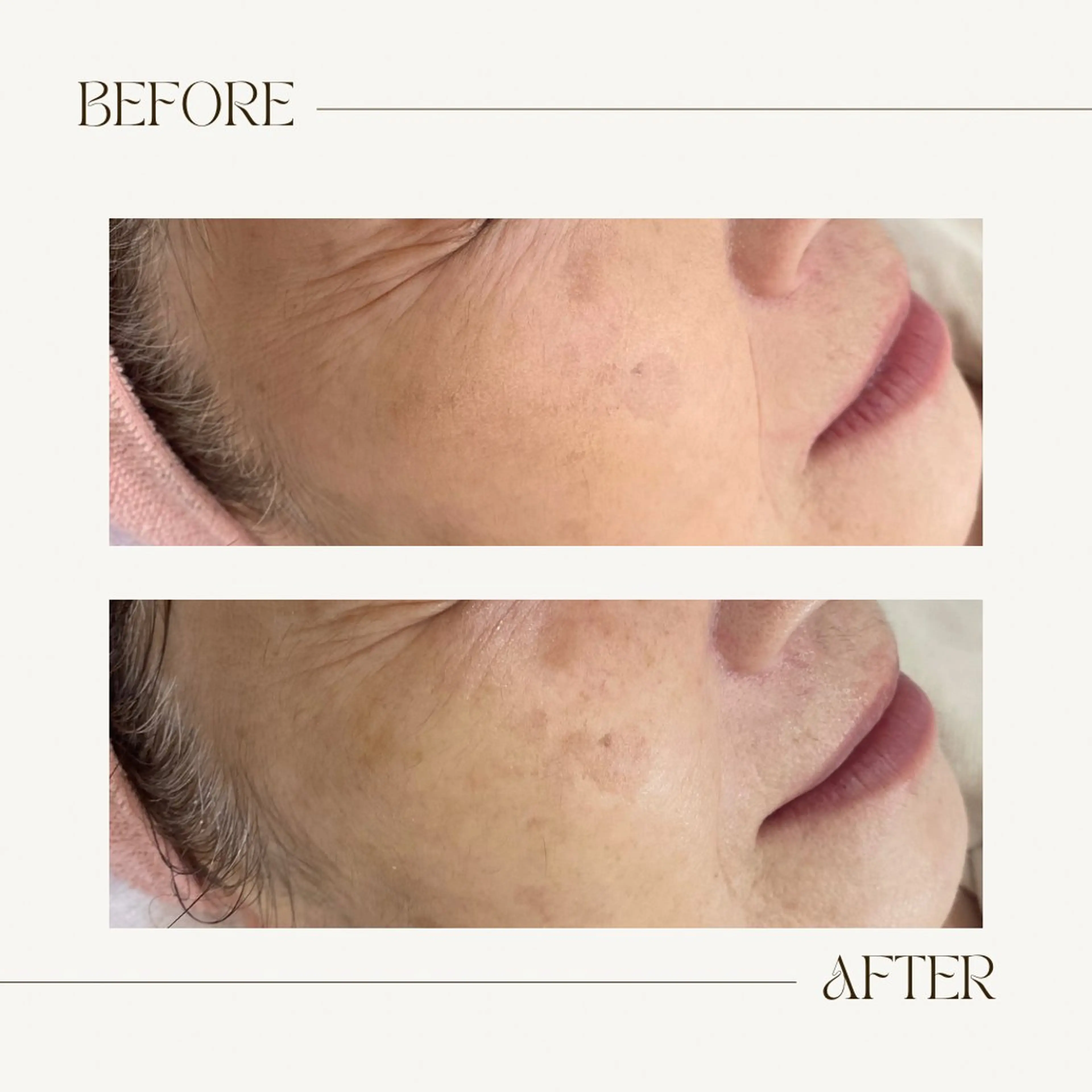 CEsalonEgg 齋藤のエステ・リラクイメージ