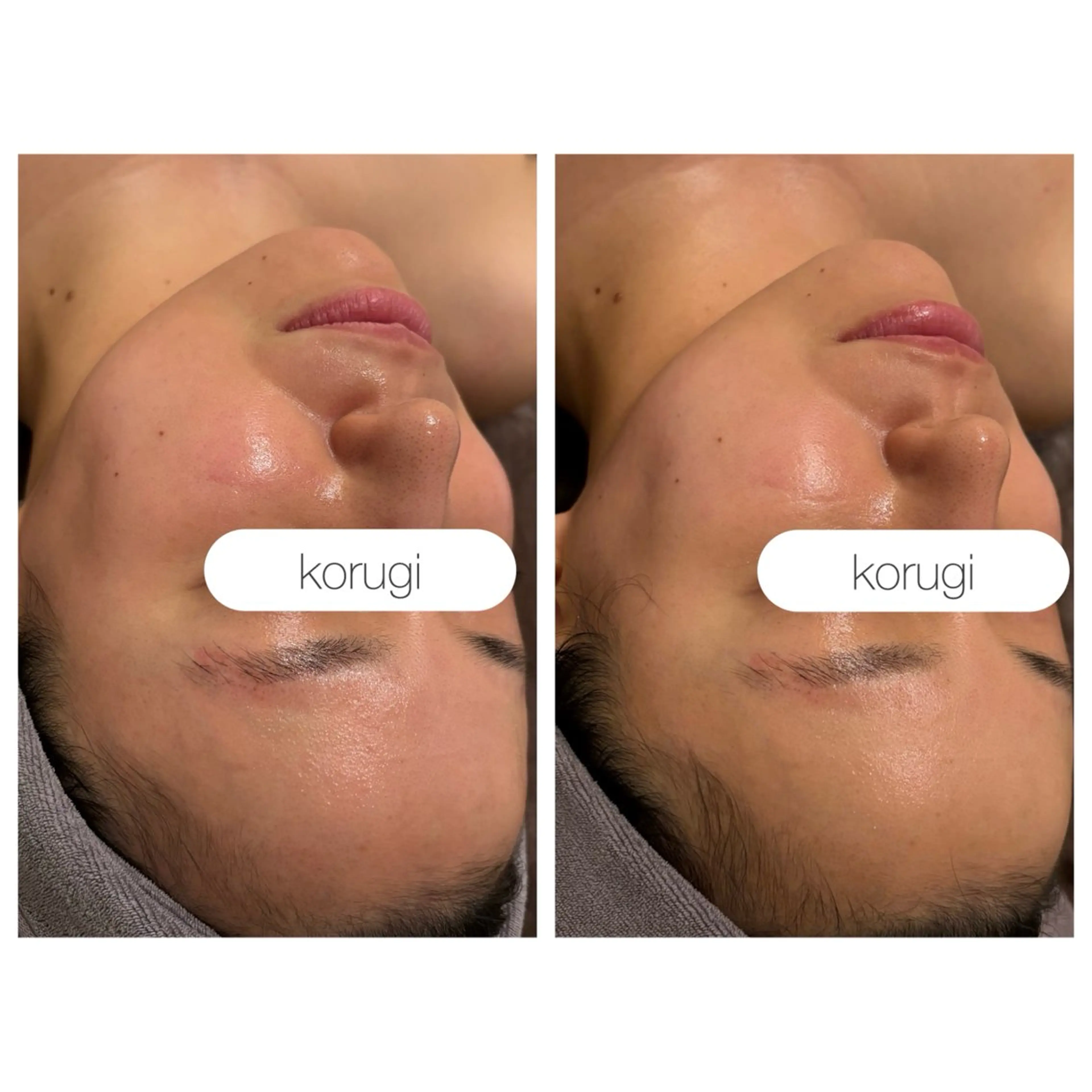 小顔コルギ ☆表参道/外苑前のエステ・リラクイメージ