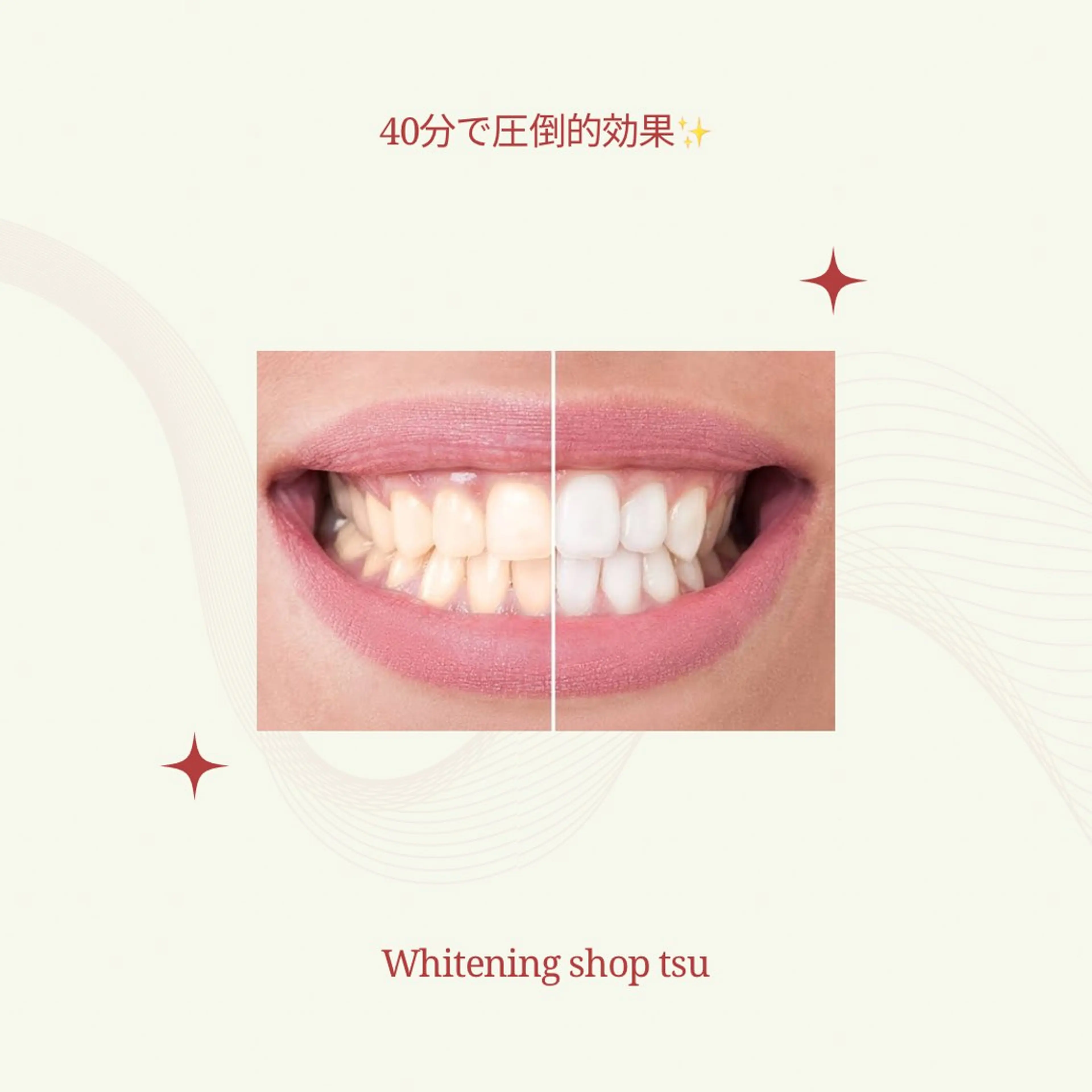 その他 ホワイトニング ショップ津店のその他イメージ