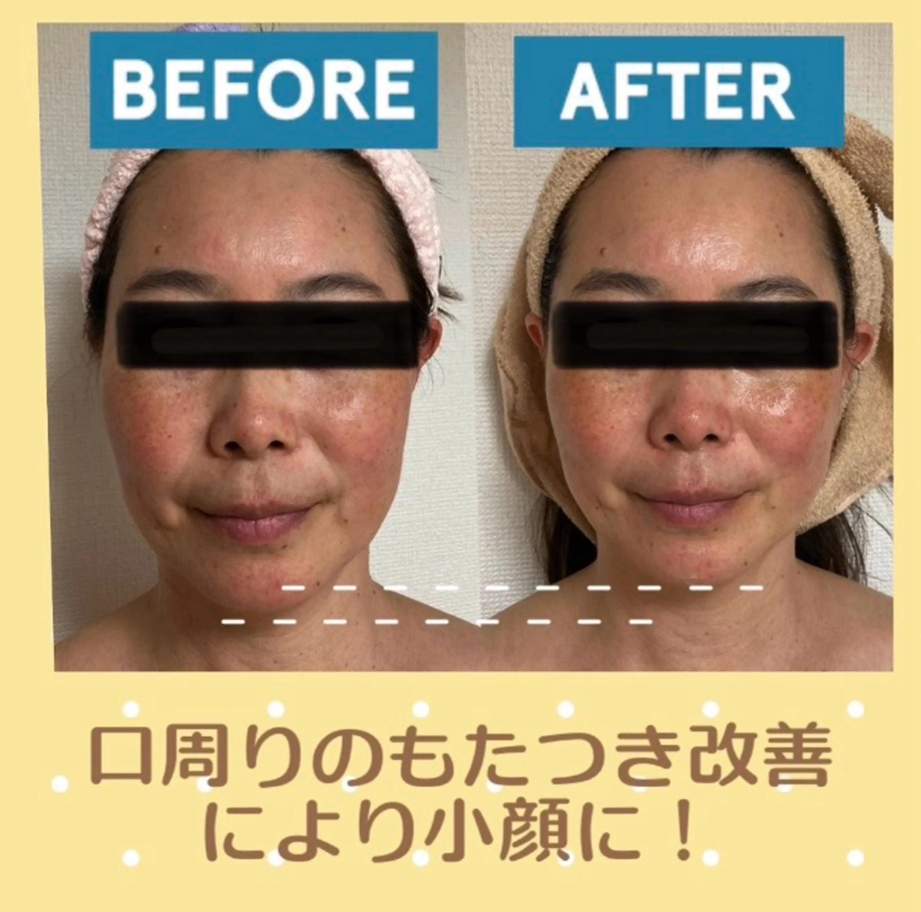 小顔矯正サロン プルメリアのエステ・リラクイメージ