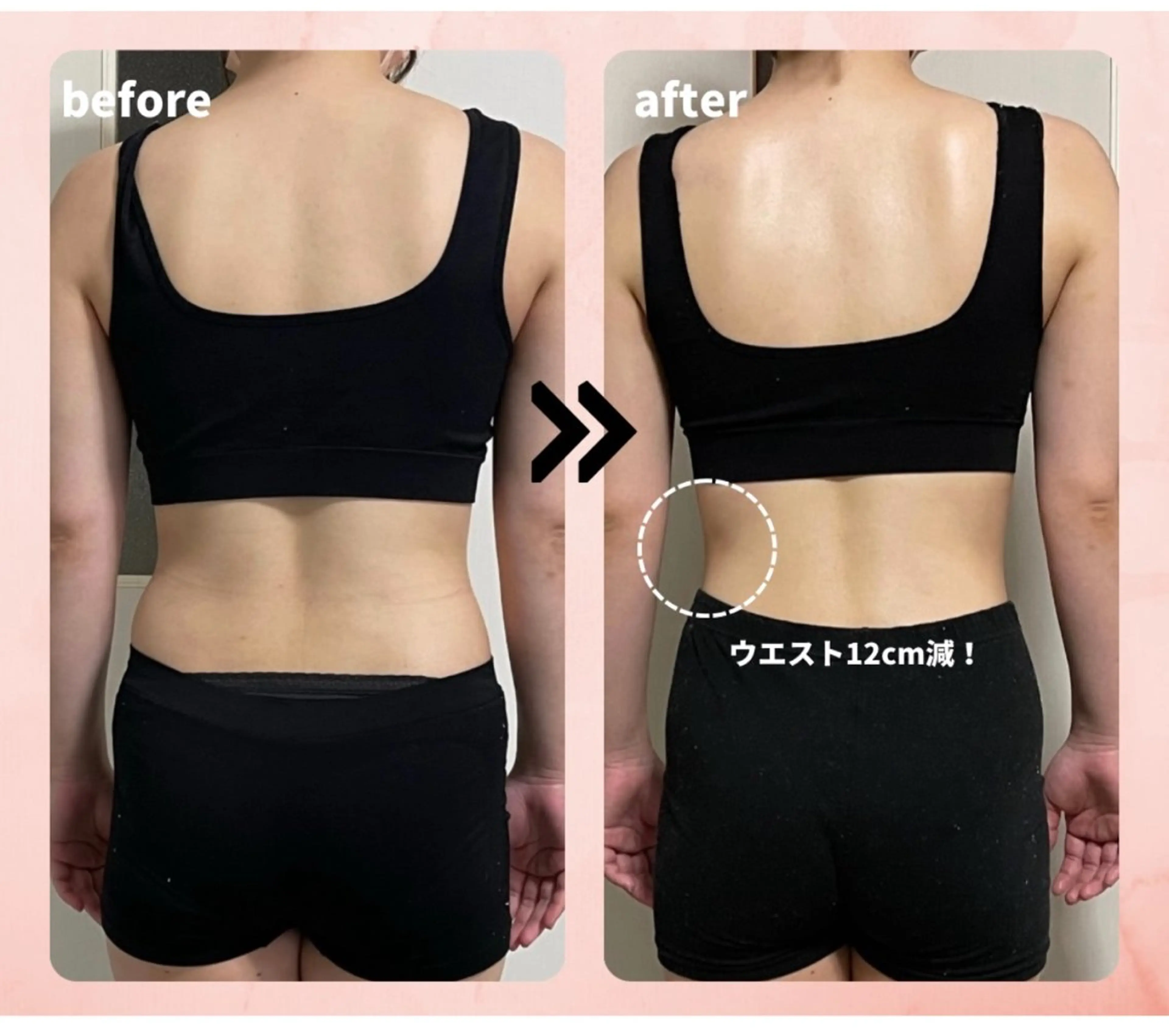 🌈女性限定 🌈専用機器を使ったリンパエステ。『どんな施術？』と気になる方まずは一度体験ください。の写真