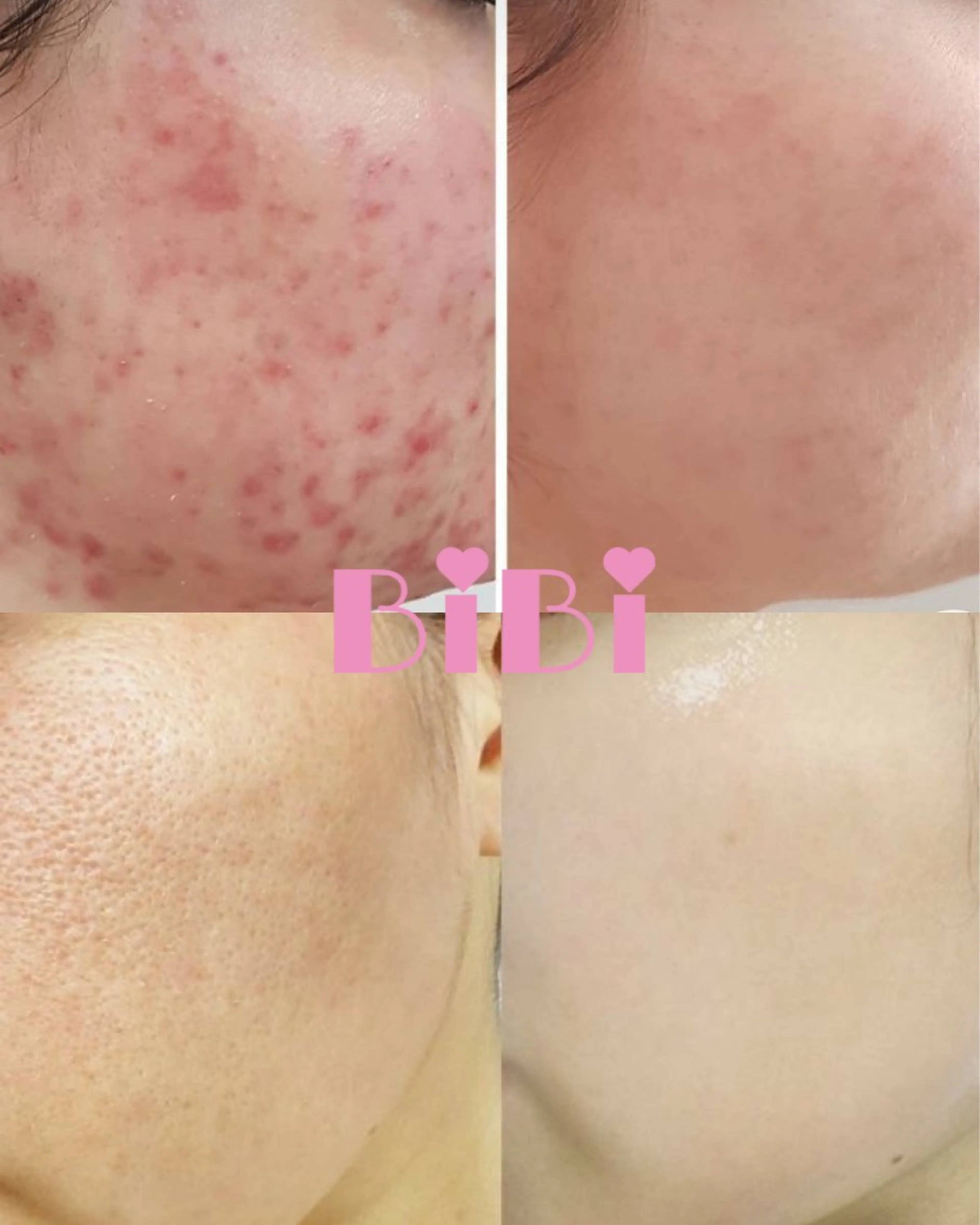 エステ 🎀BiBi韓国美容 コスパ強！美活サロンのエステ・リラクイメージ