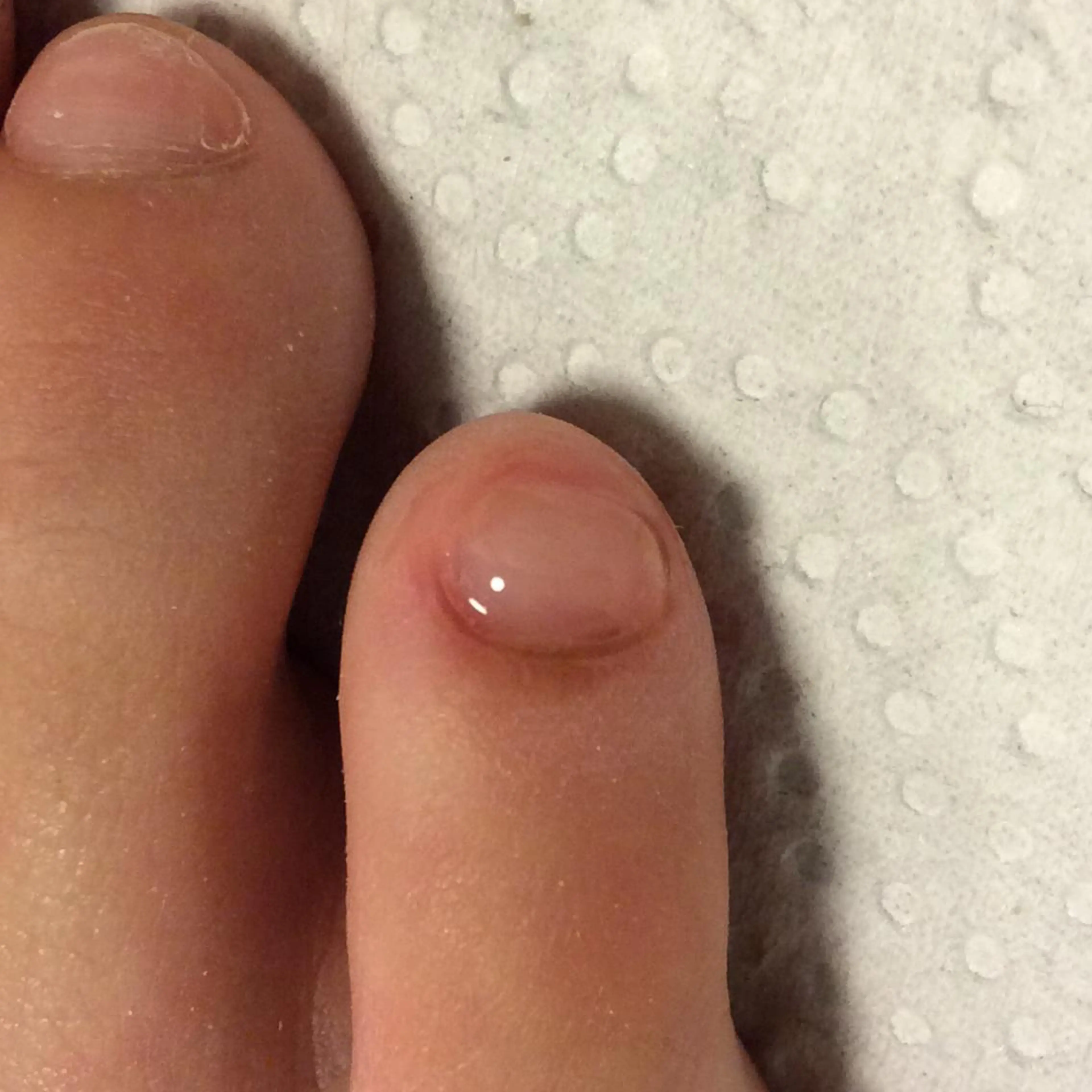 ショート メンズ キッズ ネイル フットネイル 赤色 フットケアサロンすりーぴんぐ田端店所属・🌱 ま し お 🌱のエステ・リラクイメージ