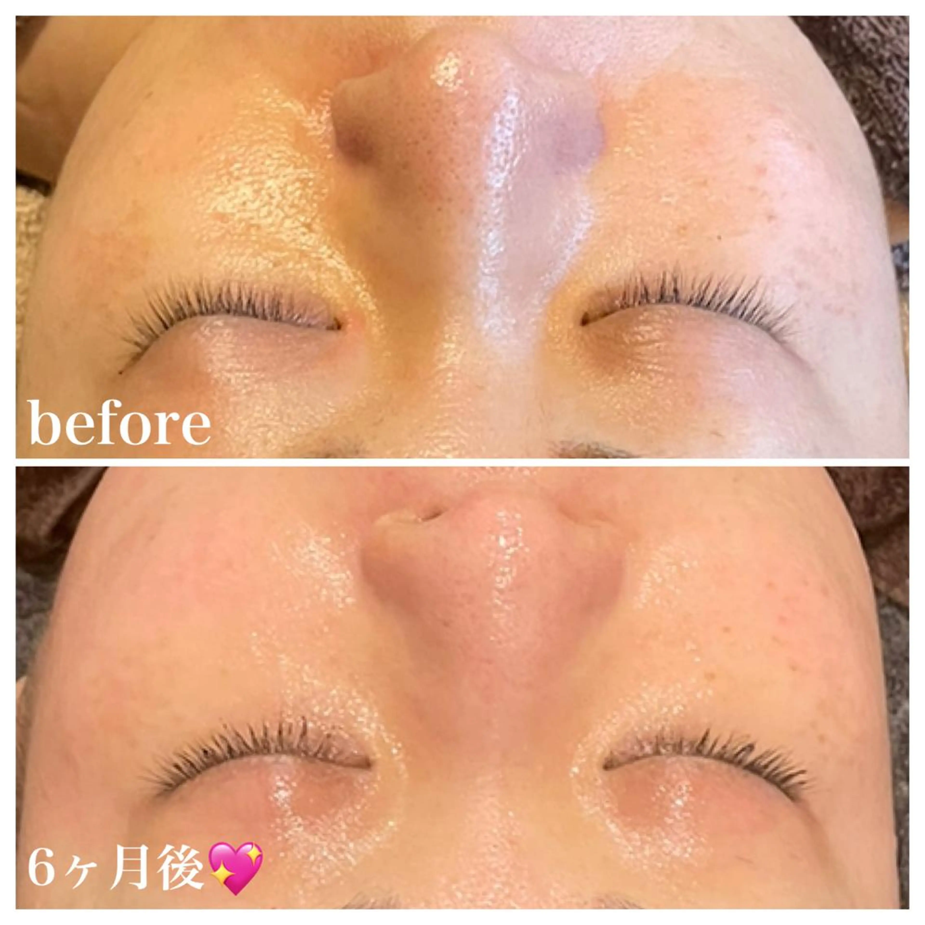 エステ 浜野 恵美のエステ・リラクイメージ