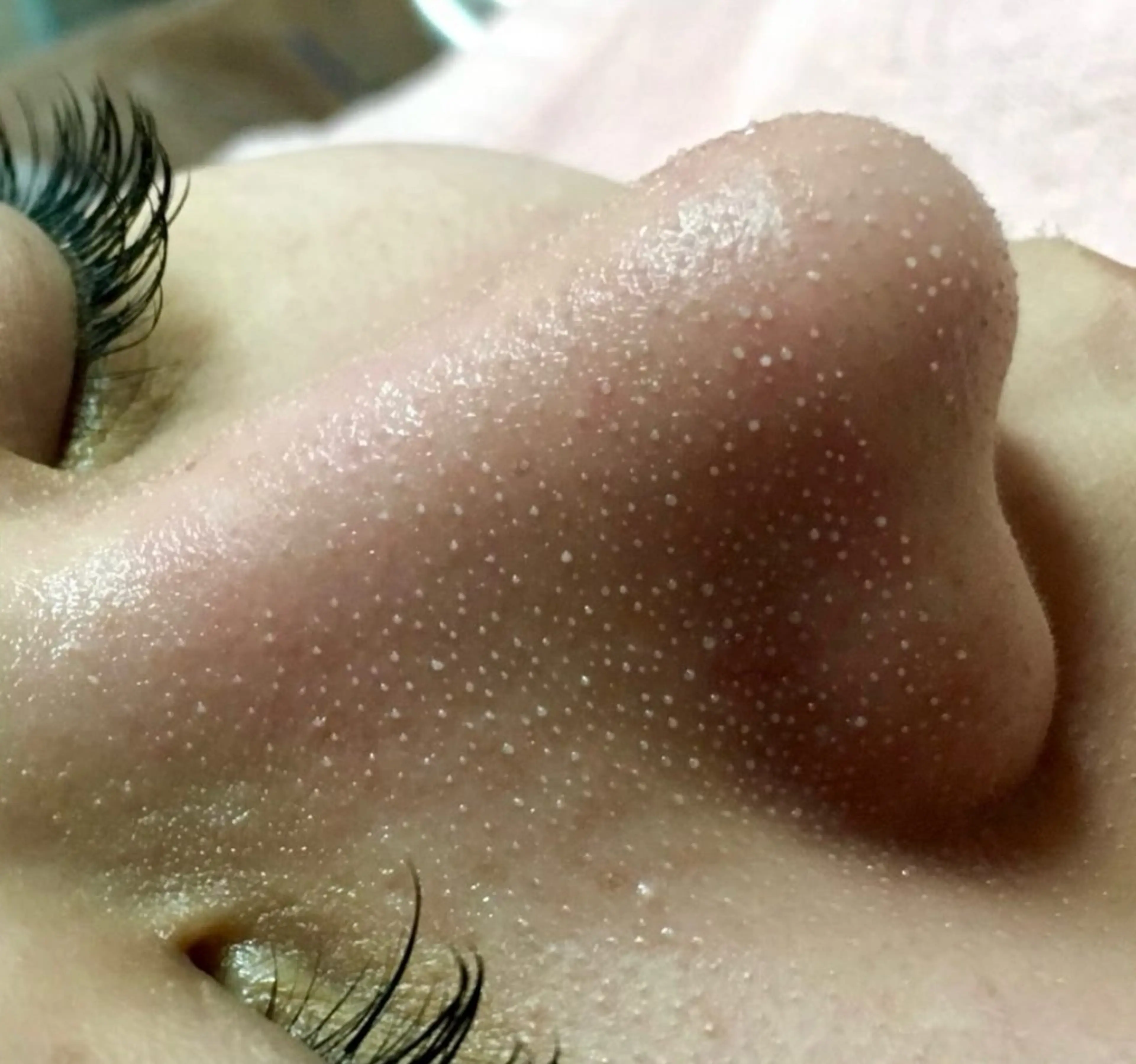 小顔・毛穴/ニキビ/ ハーブピーリング専門のエステ・リラクイメージ