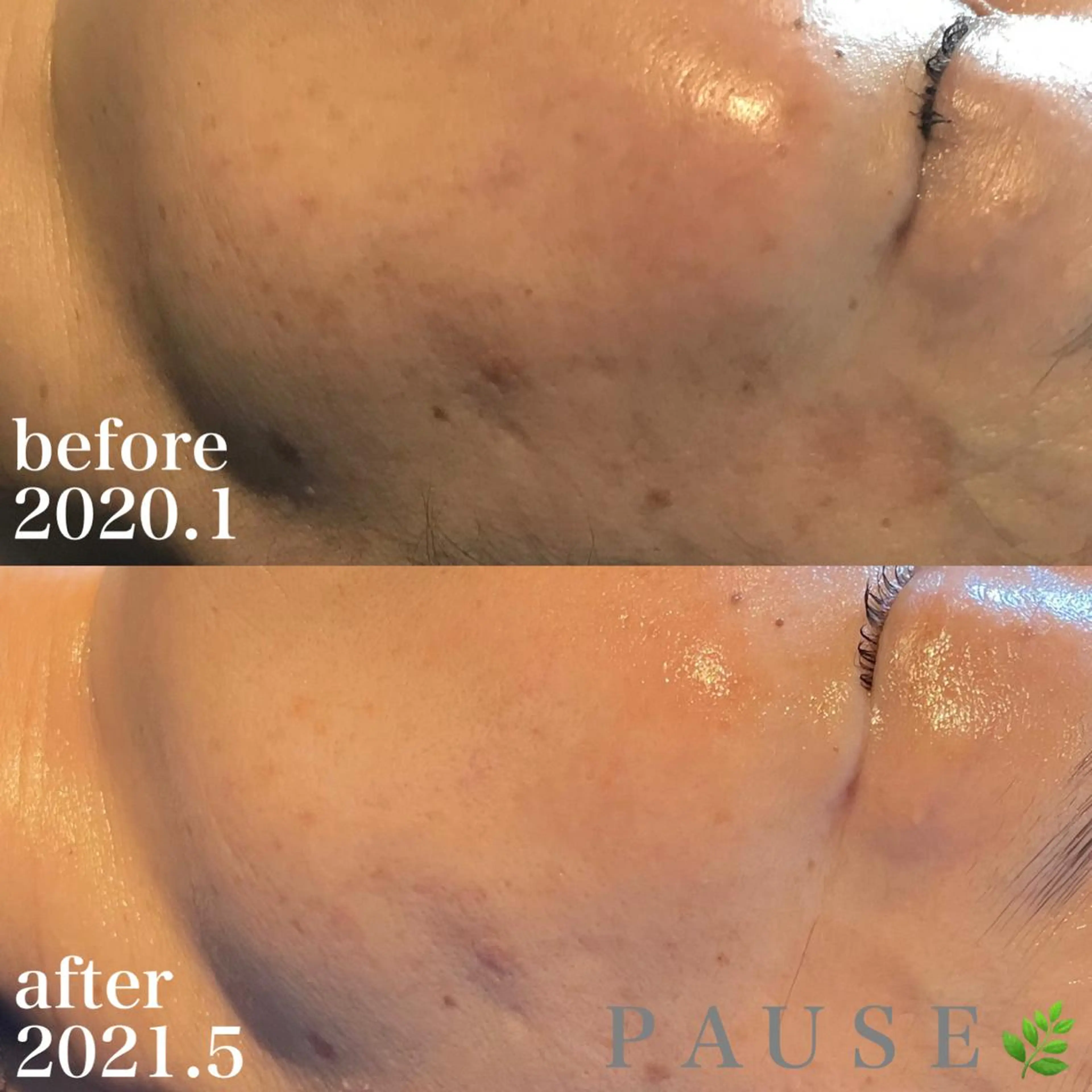 エステ 浜野 恵美のエステ・リラクイメージ