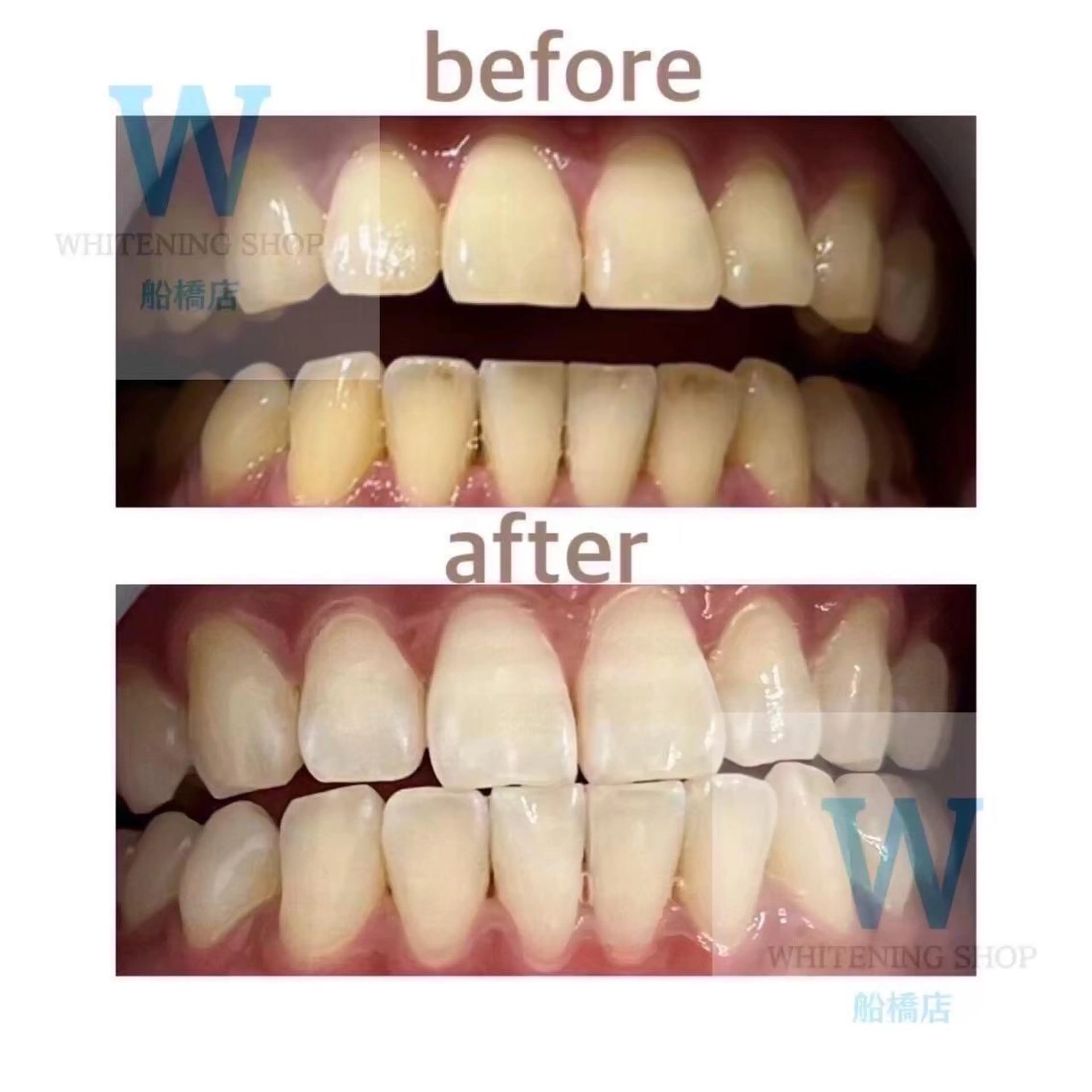 エステ リラク ホワイトニング ショップ船橋店🦷のエステ・リラクイメージ