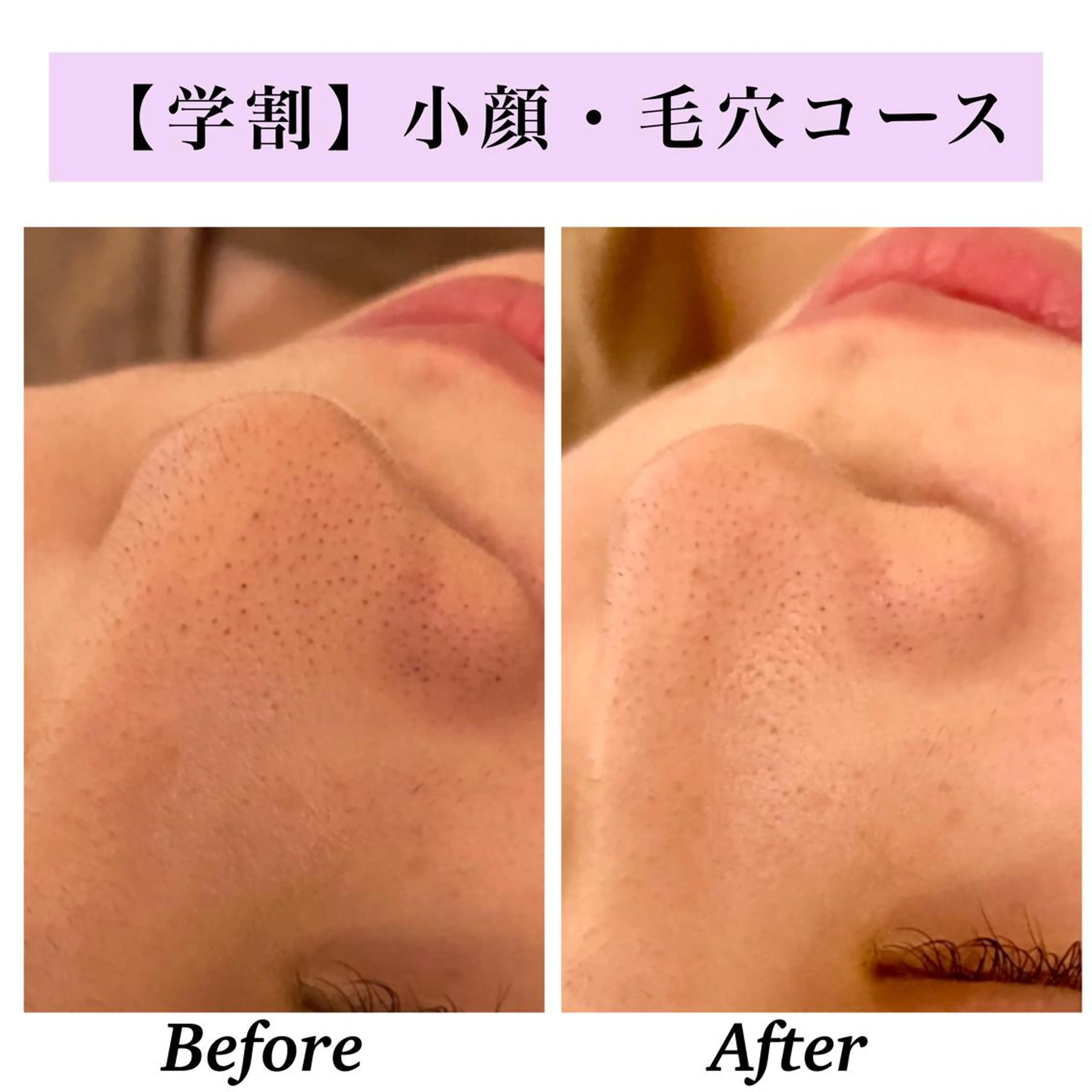 Bellesthe （ベルエステ）のエステ・リラクイメージ