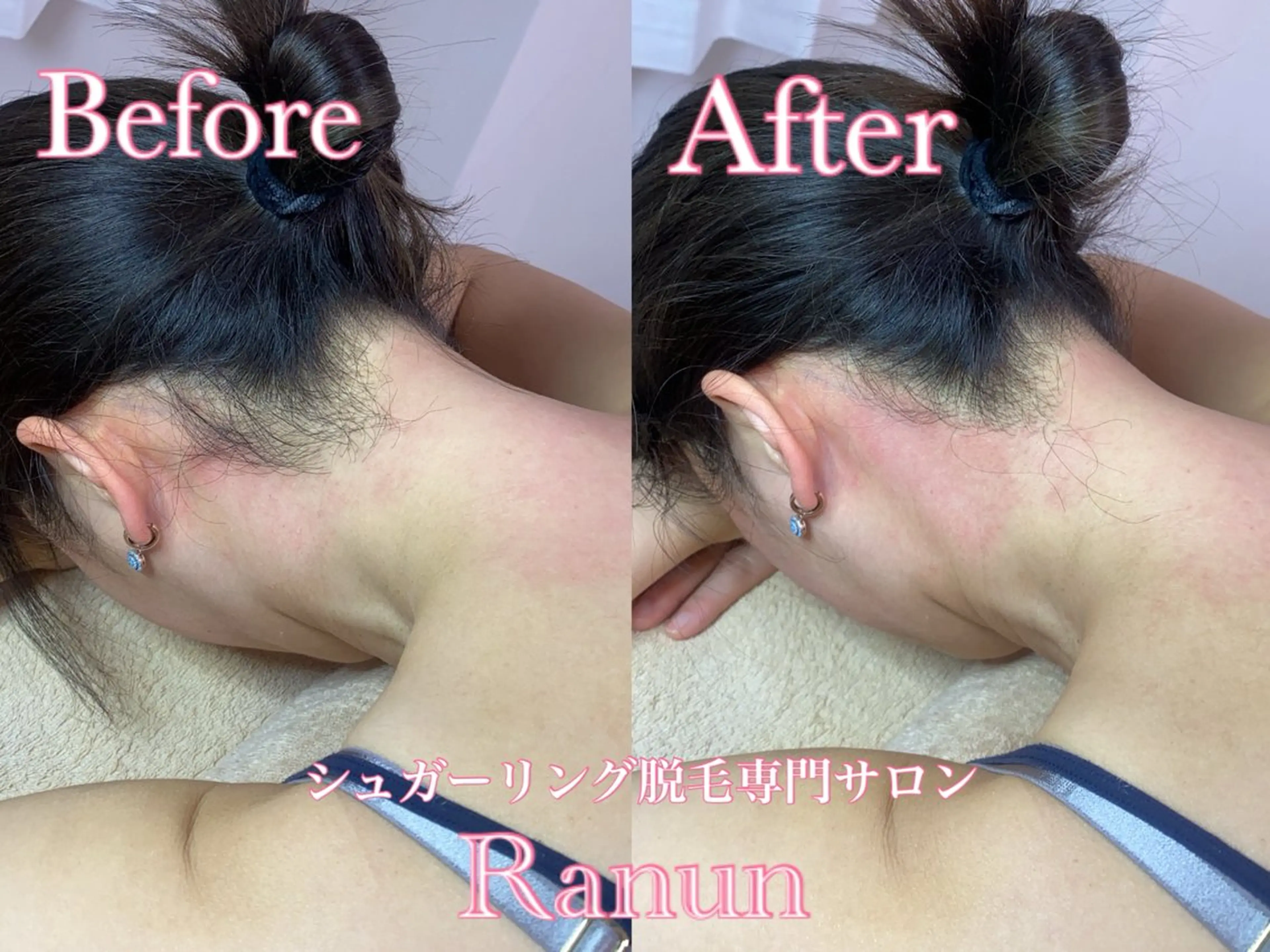 マツエク・マツパ 脱毛 シュガーリング脱毛 専門店Ranunのエステ・リラクイメージ