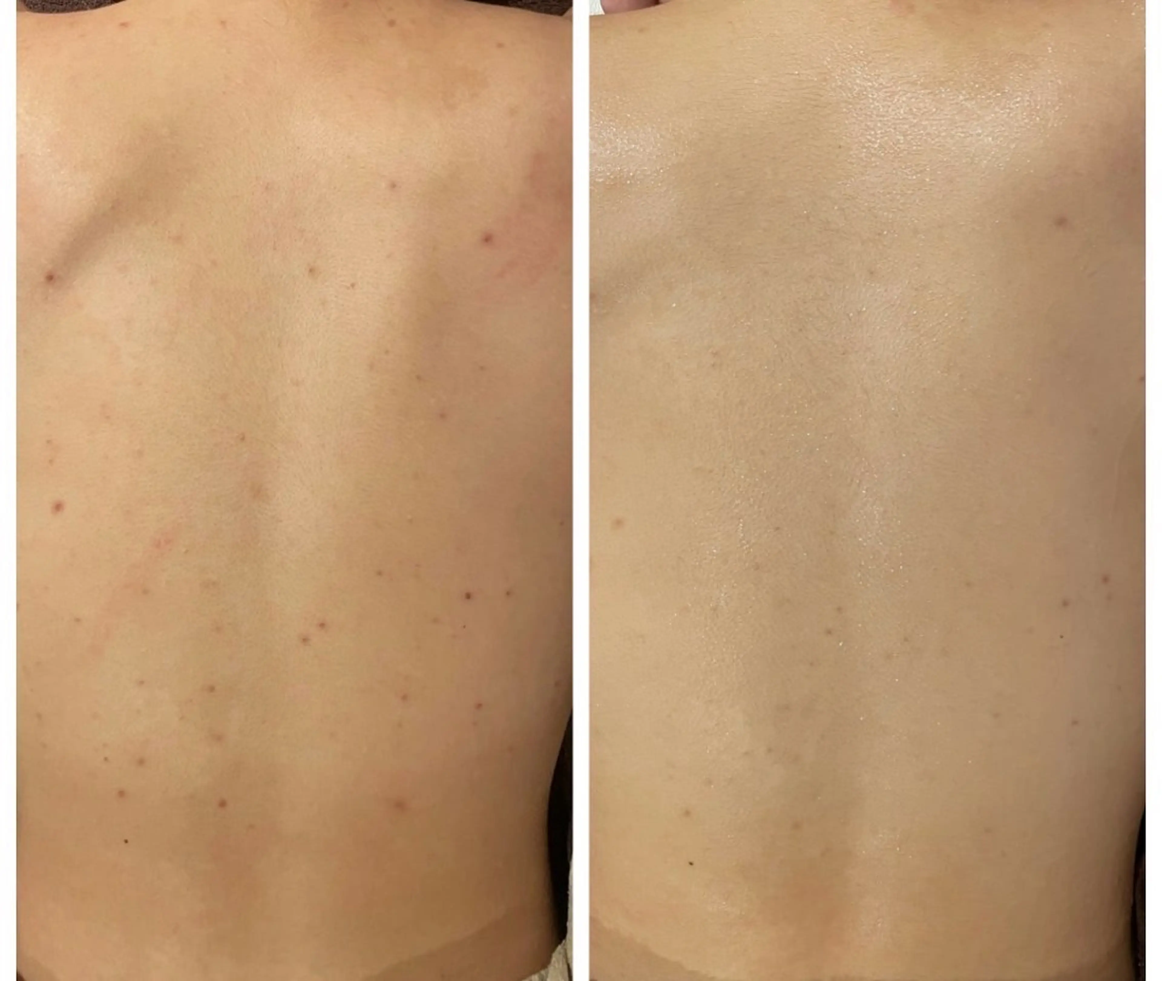 その他 for woman所属・森 美優のエステ・リラクイメージ