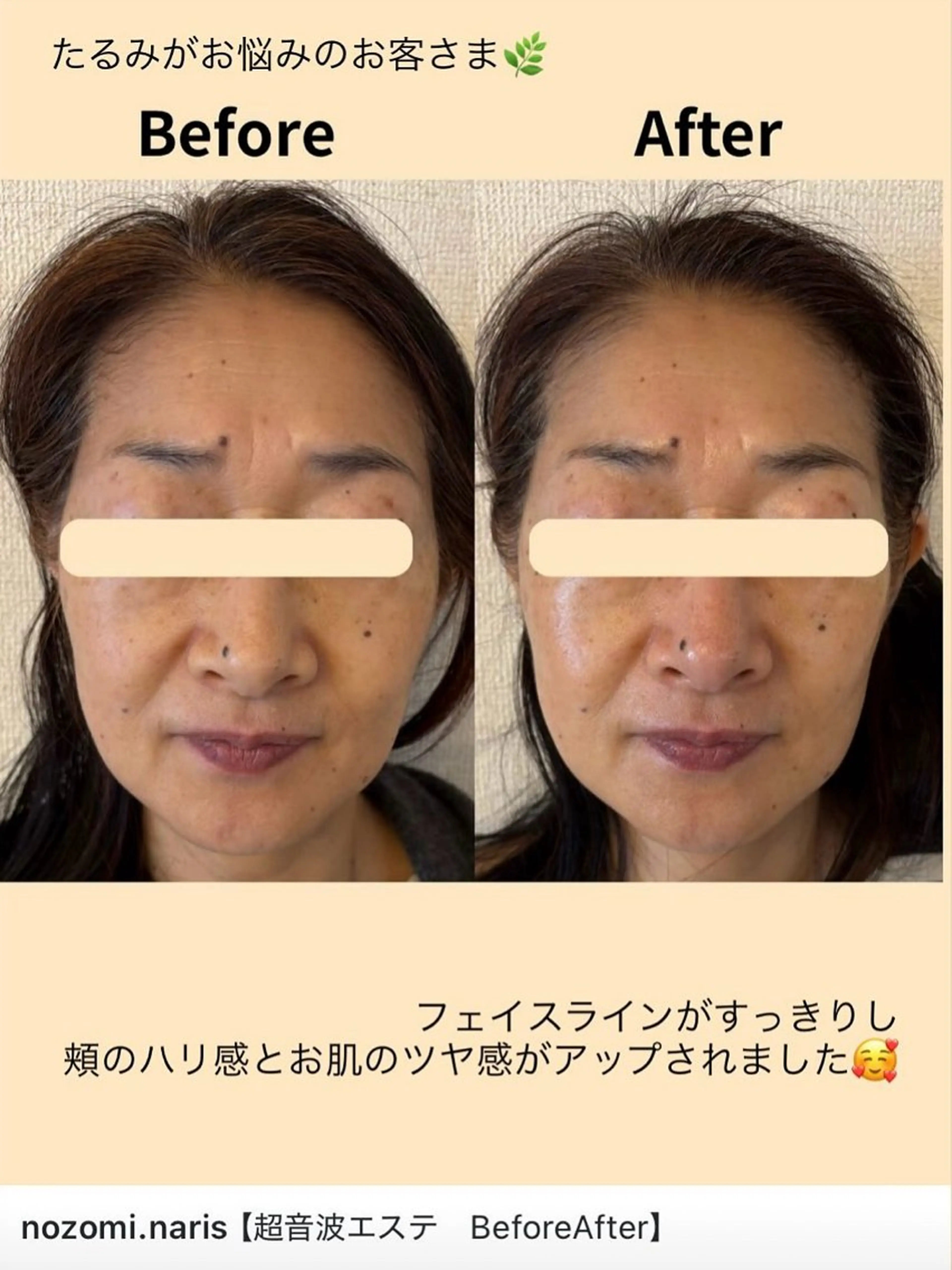 エステ nozomi.m🌷 narisのエステ・リラクイメージ