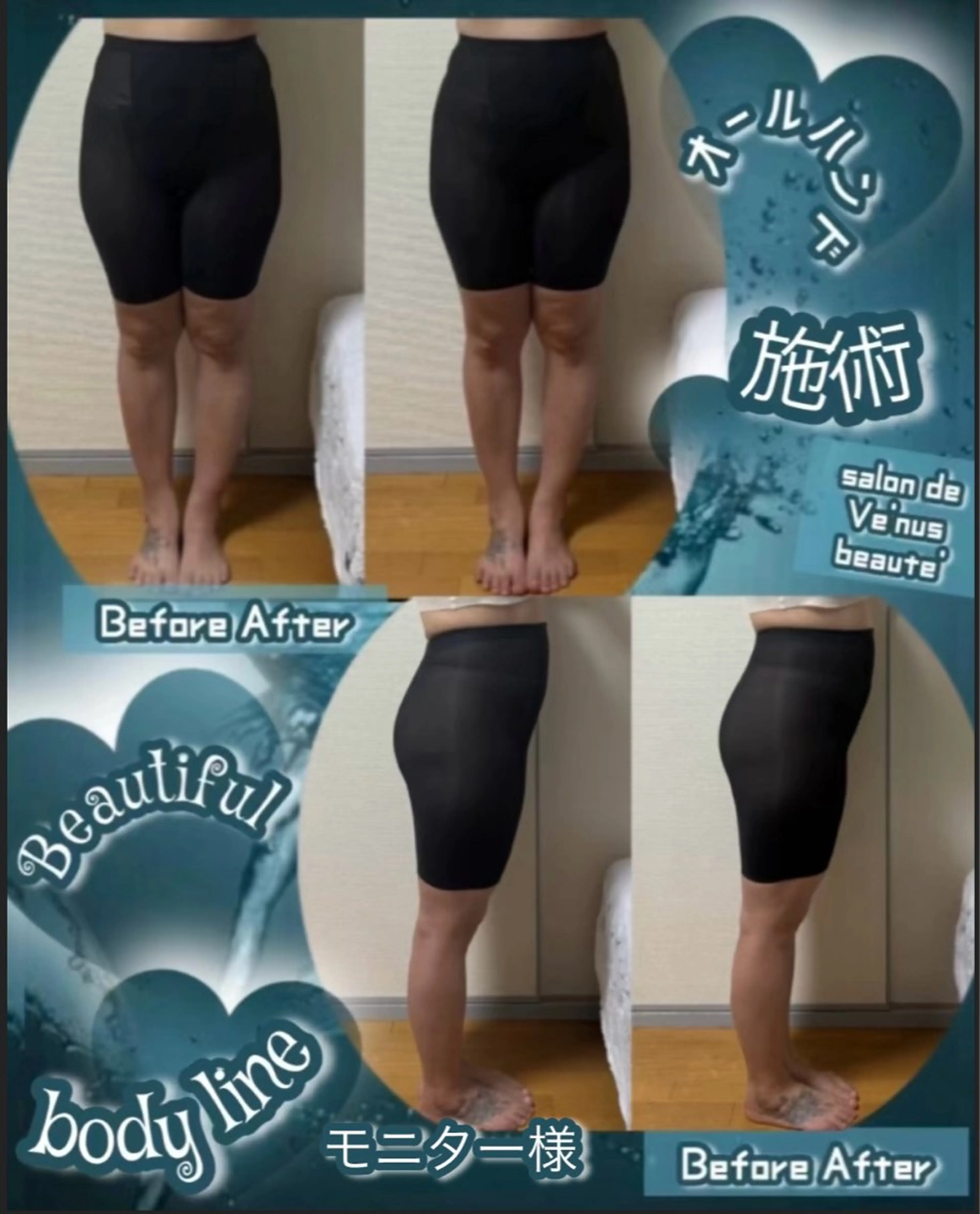 ヴィーナス ビューティーのエステ・リラクイメージ