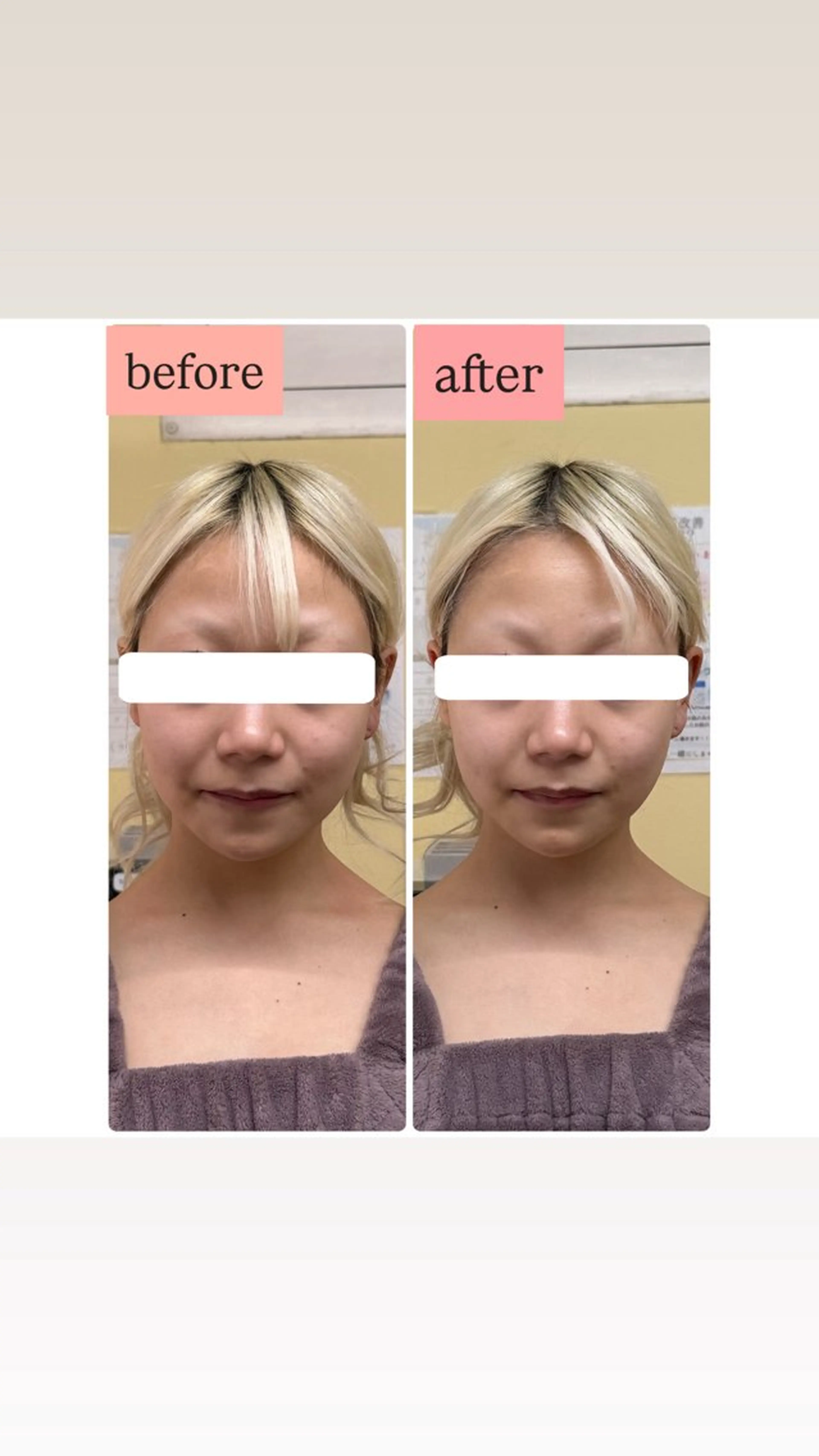 エステ リラク MIRAI小顔 岡山店のエステ・リラクイメージ