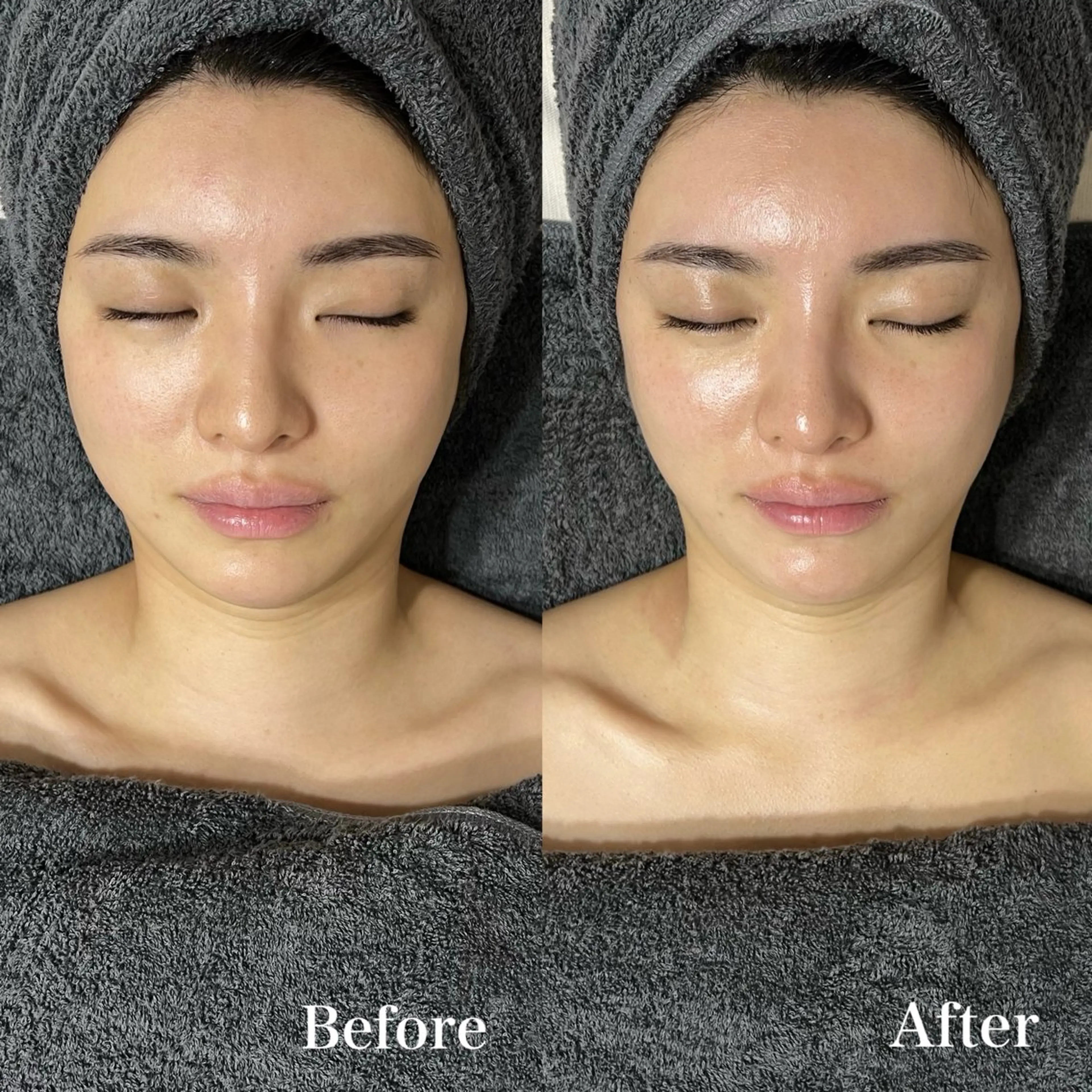 【小顔◎肌修復◎肌修復◎】陶肌トリートメント➕CYリキッド0.8mlの写真