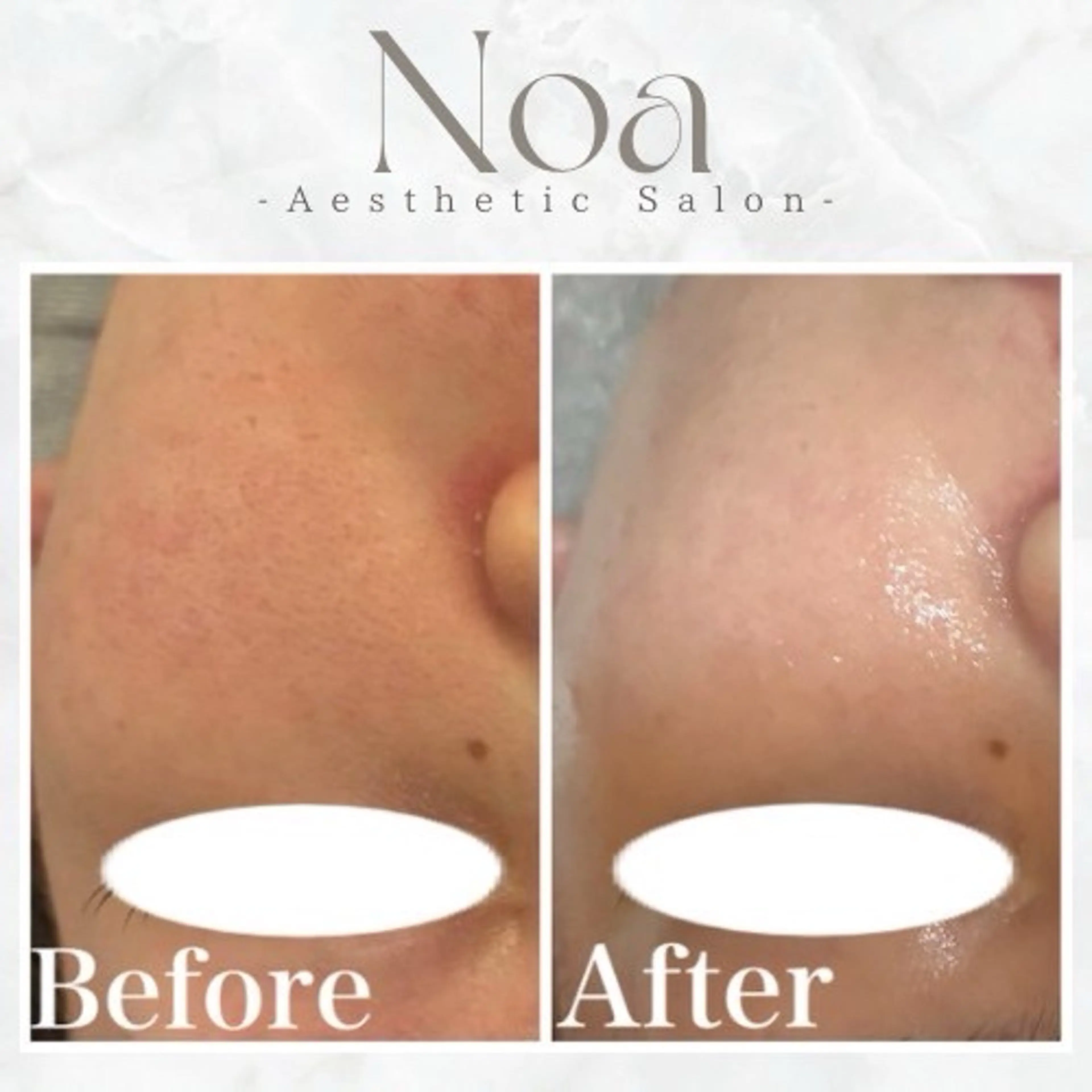 肌質改善サロン Noaのエステ・リラクイメージ