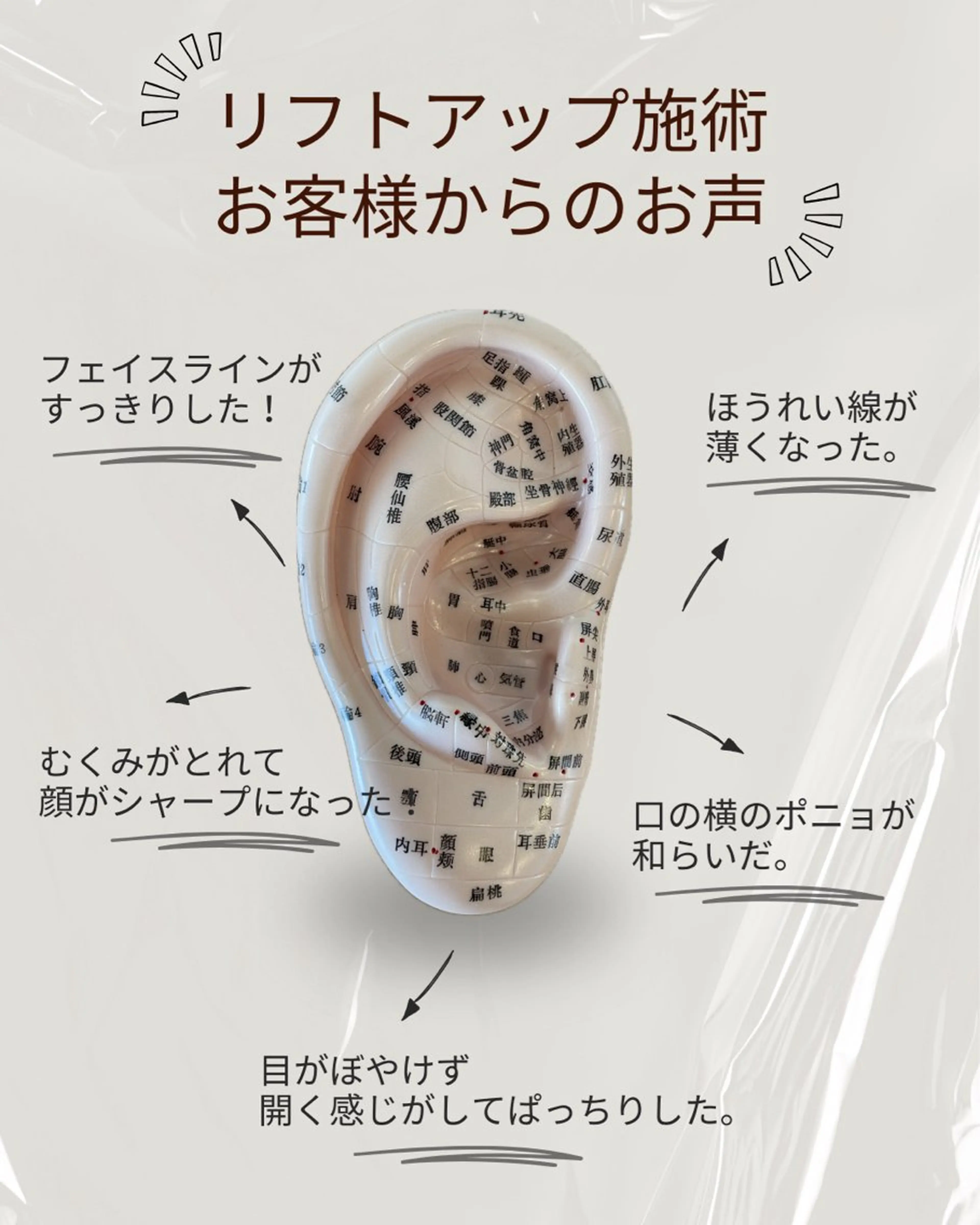 mimine エメラルド式耳つぼのその他イメージ