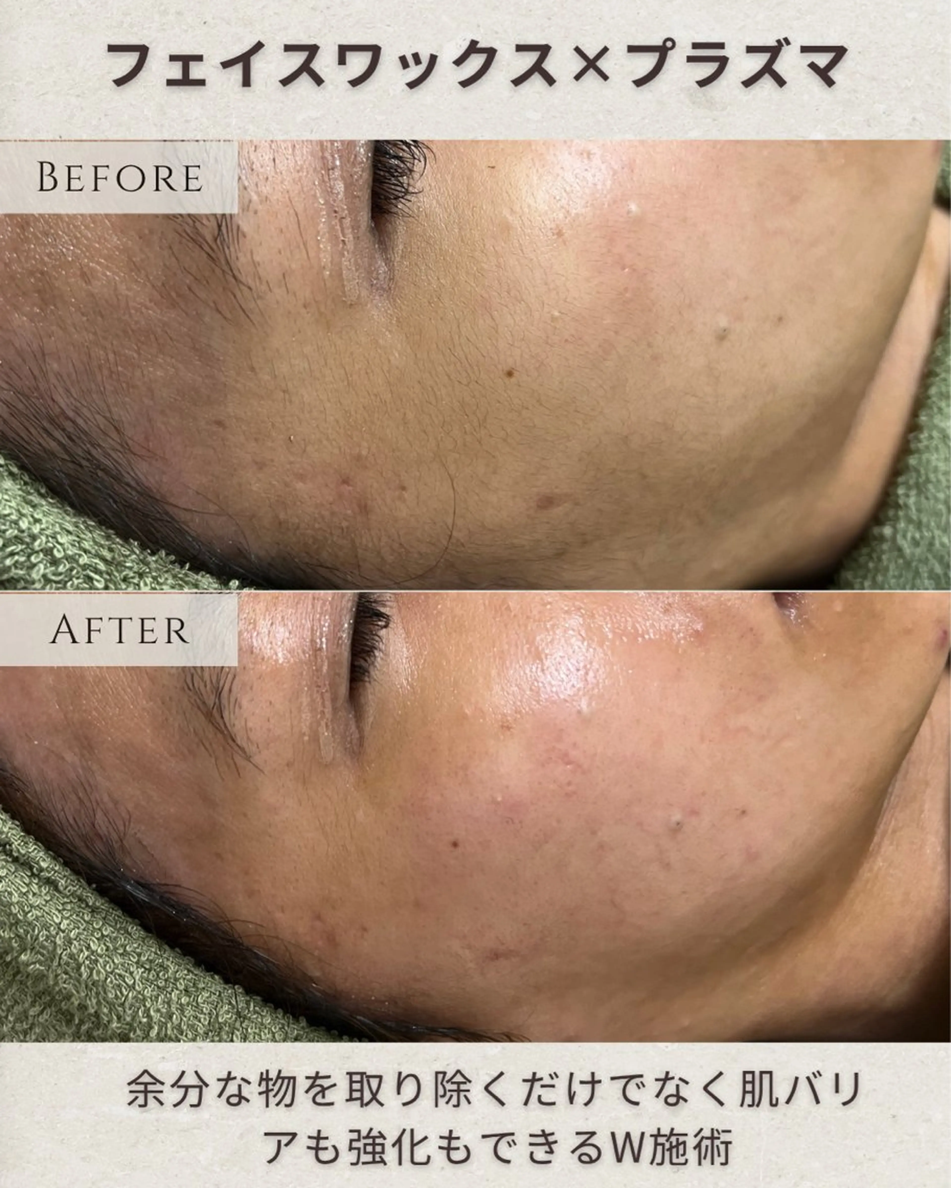 稲垣 優のエステ・リラクイメージ