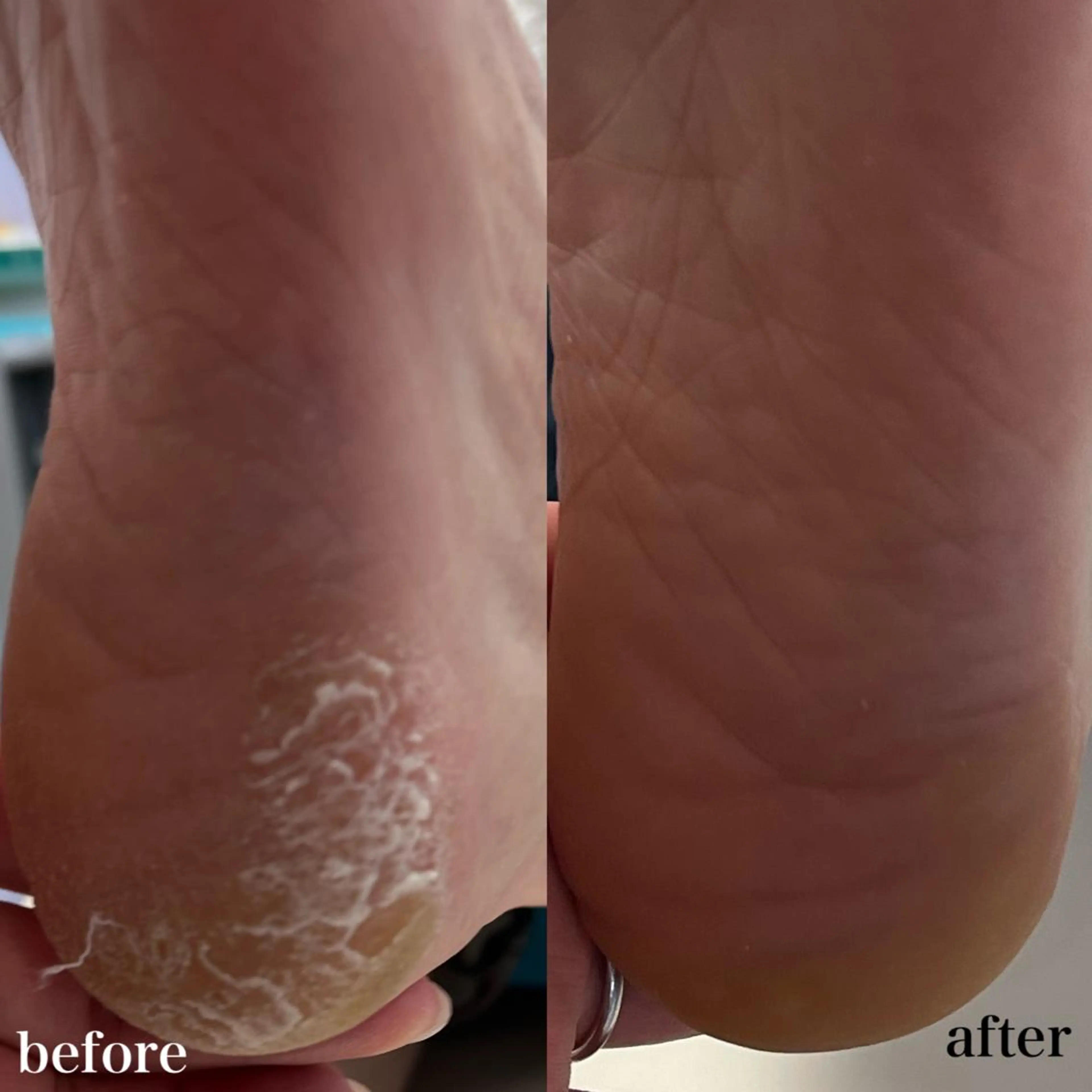 メンズ ネイル エステ リラク 𝐑𝐢𝐞𝐯𝐞所属・HIROTA 𝐑𝐀𝐍のエステ・リラクイメージ