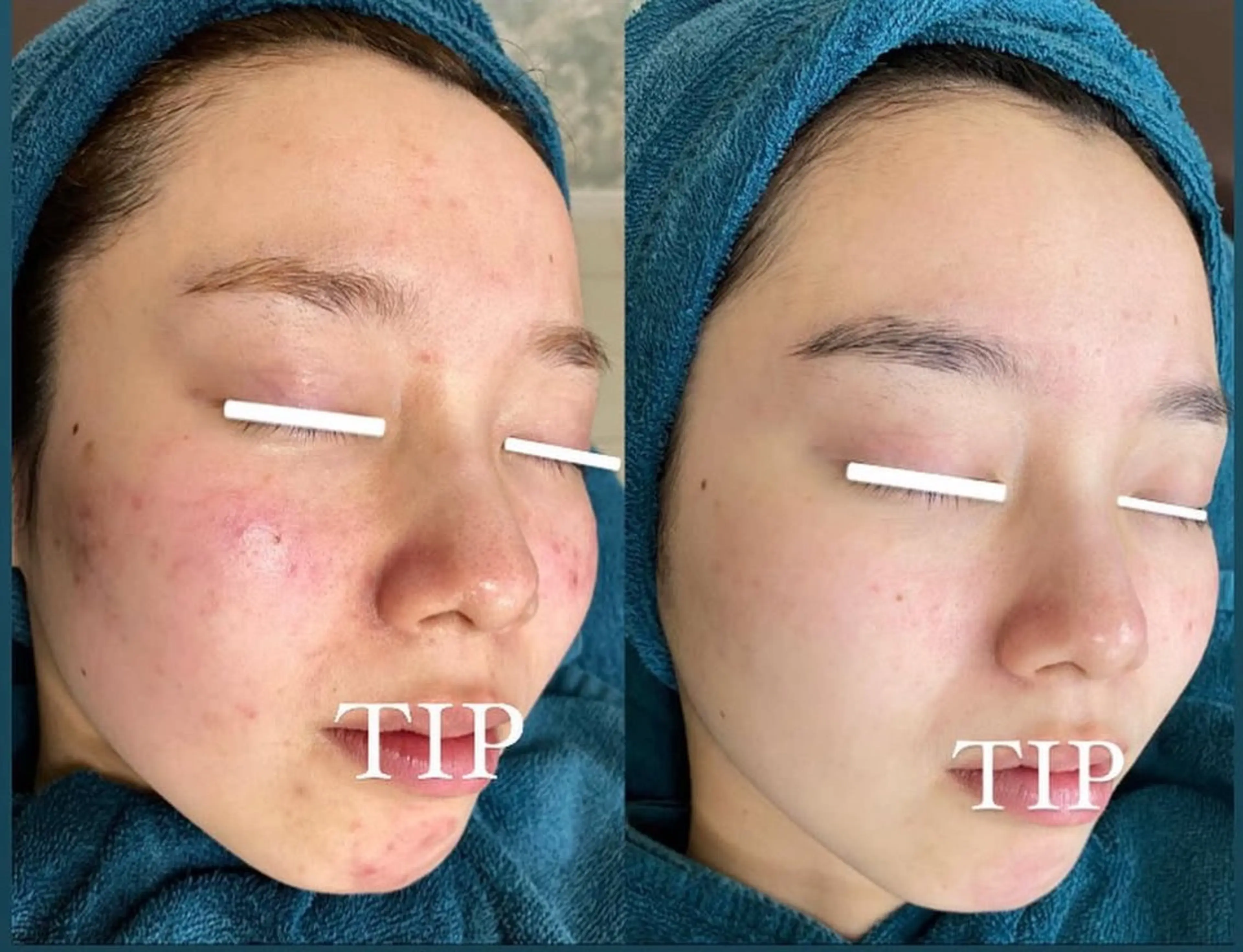 メンズ 山村 有花のエステ・リラクイメージ