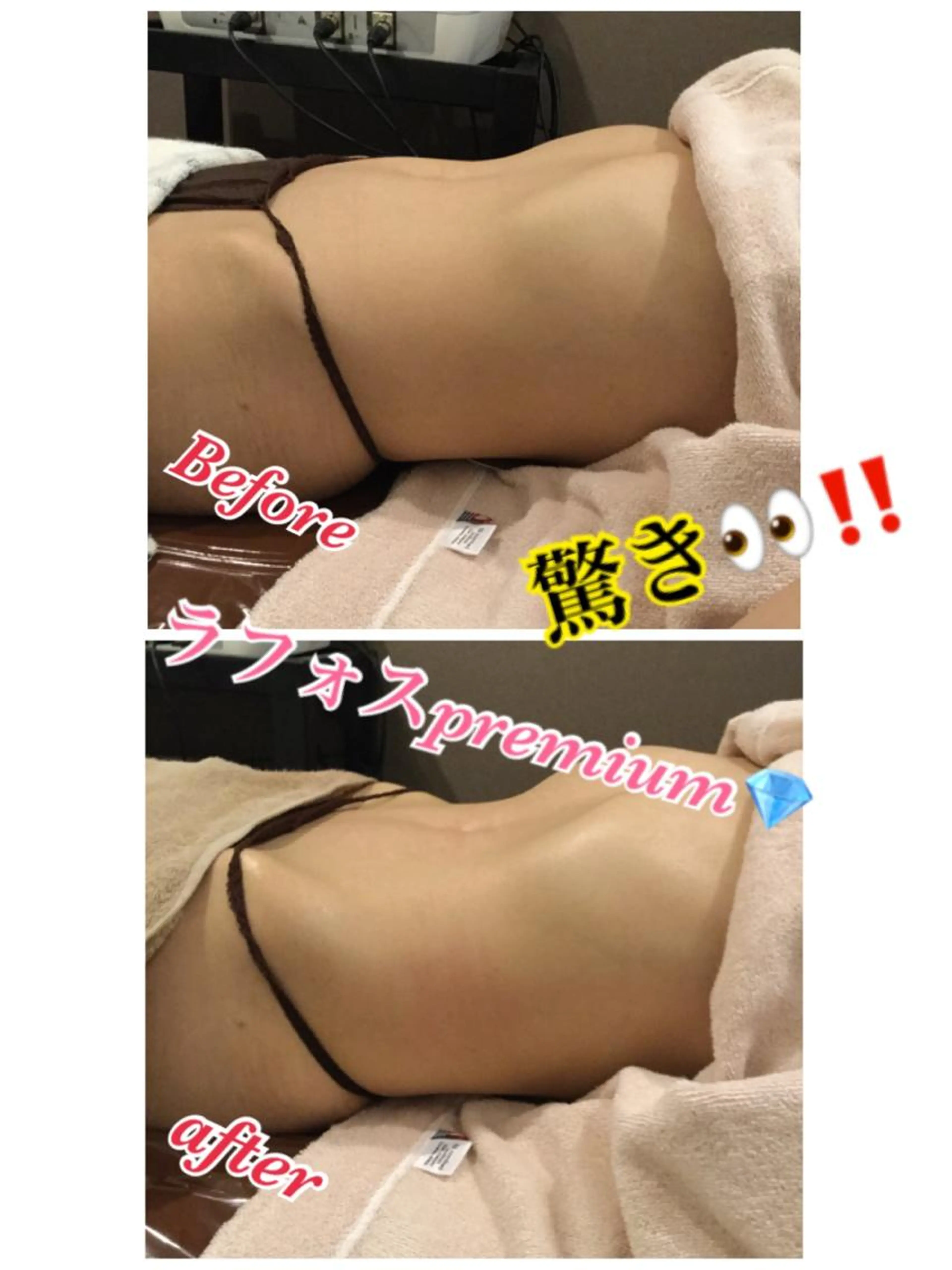 【新規限定】ラフォスpremiumの写真