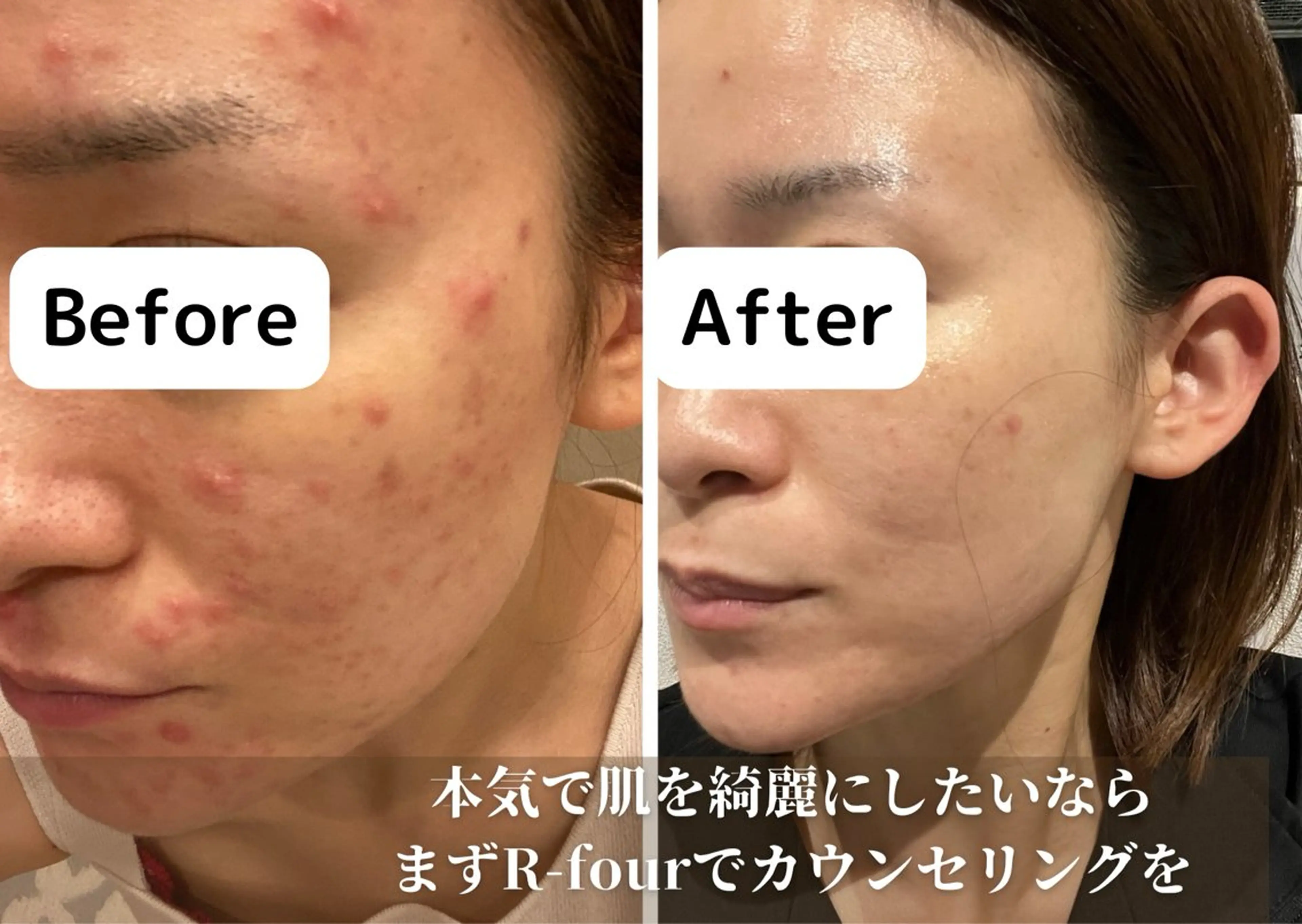 R-four🦋 土屋のエステ・リラクイメージ