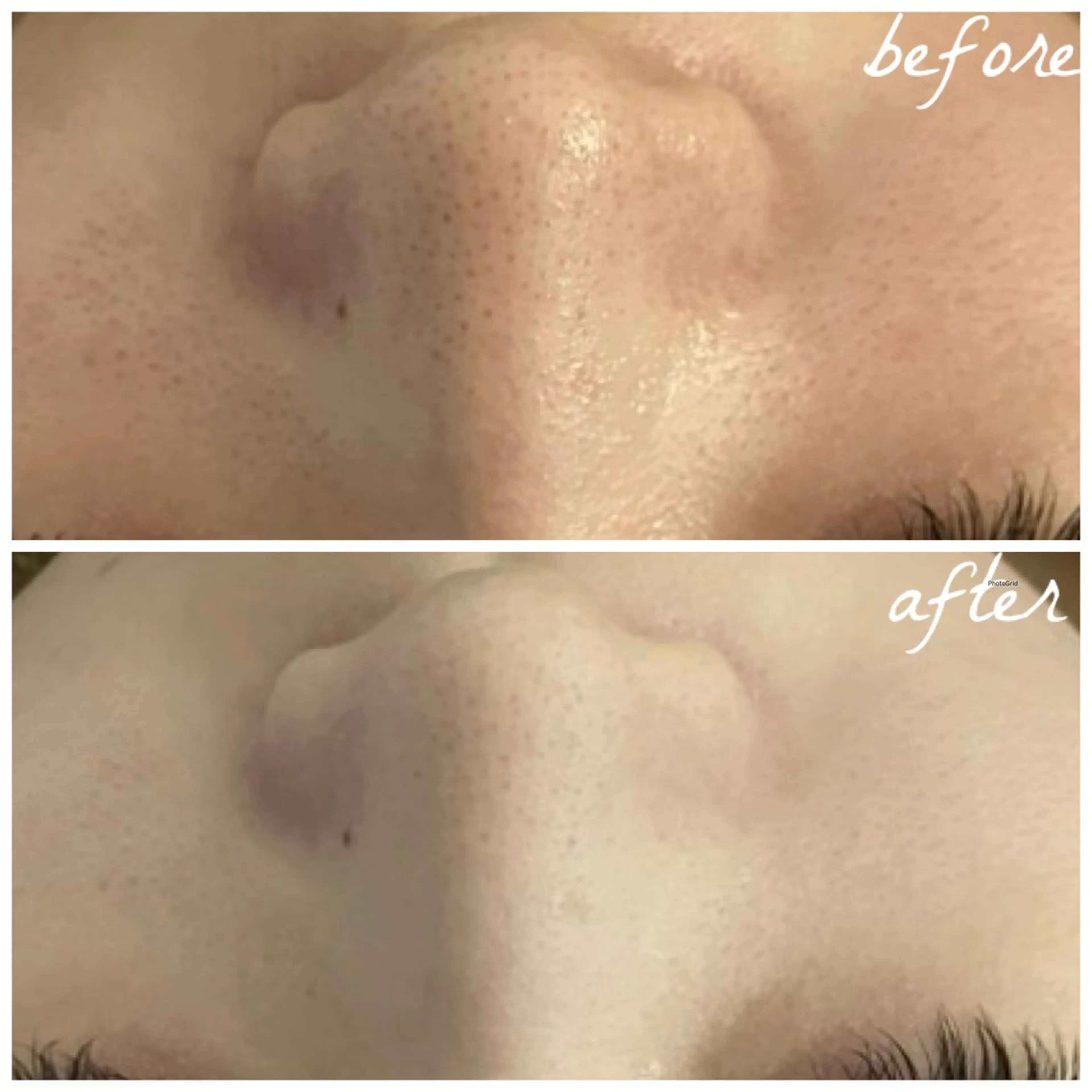 メンズ エステ メナード岐阜茜部 杉浦のエステ・リラクイメージ