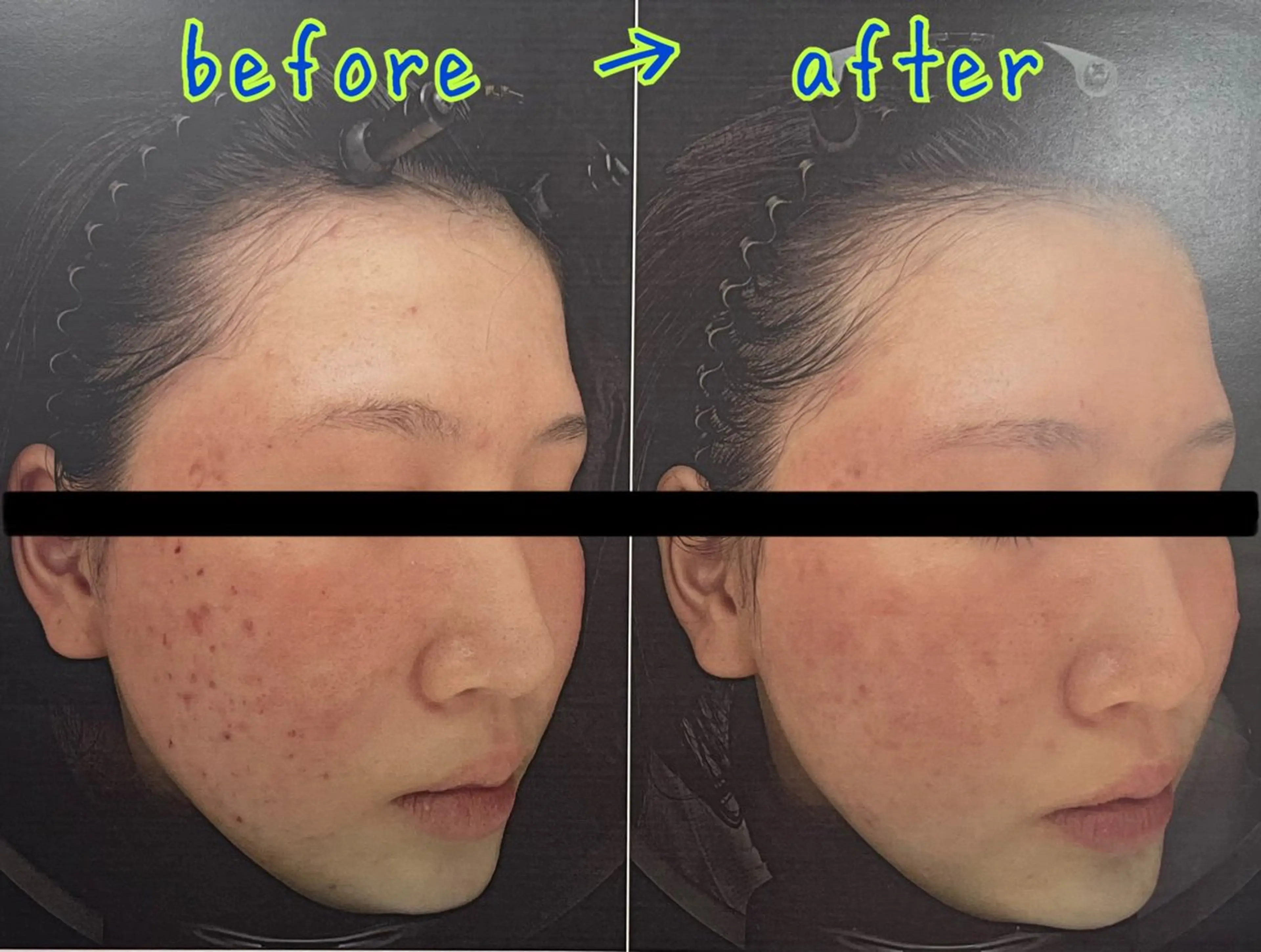 エステ 口コミ★5獲得 Claire鈴木のエステ・リラクイメージ