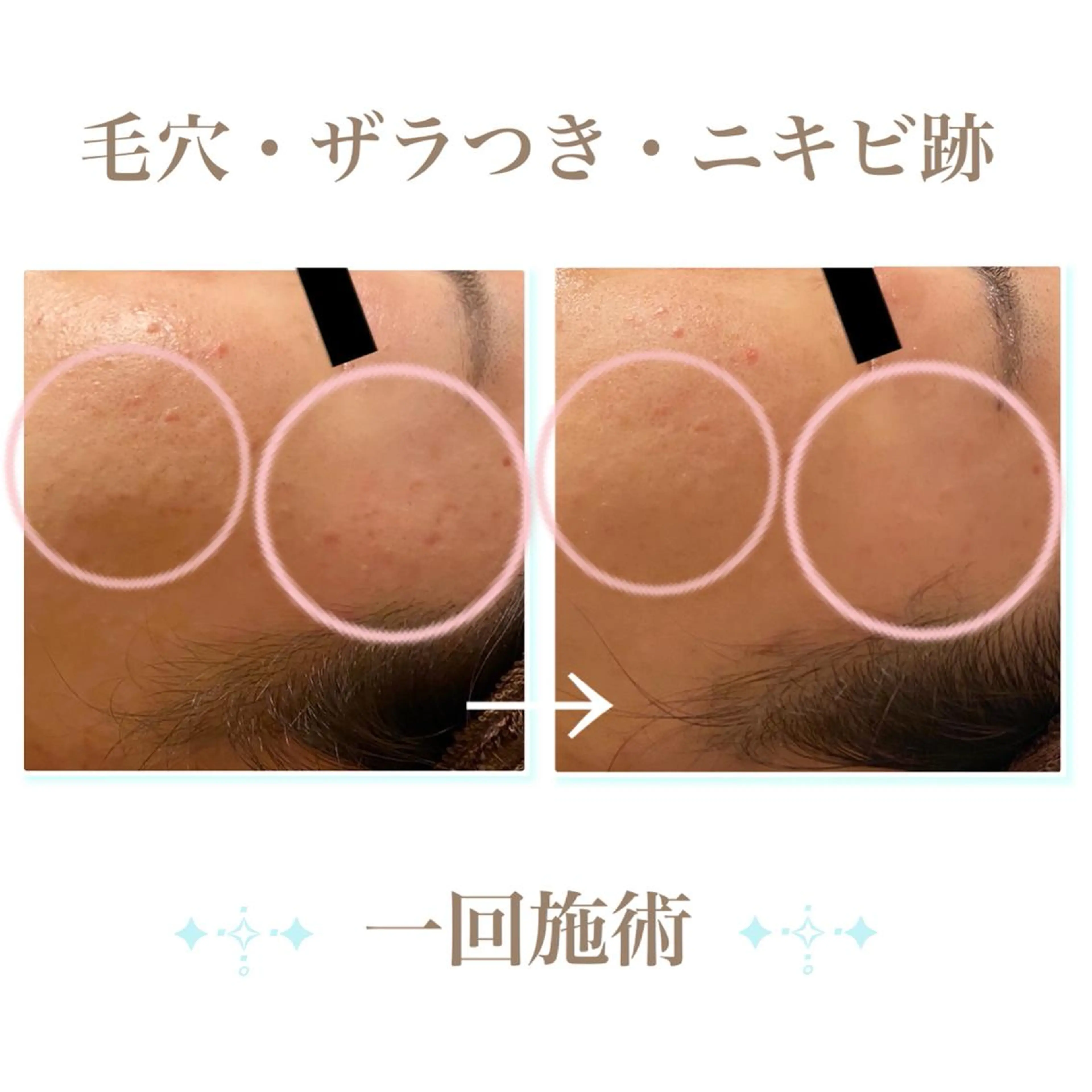 エステ リラク ダイエット・美肌ケア fleurのエステ・リラクイメージ