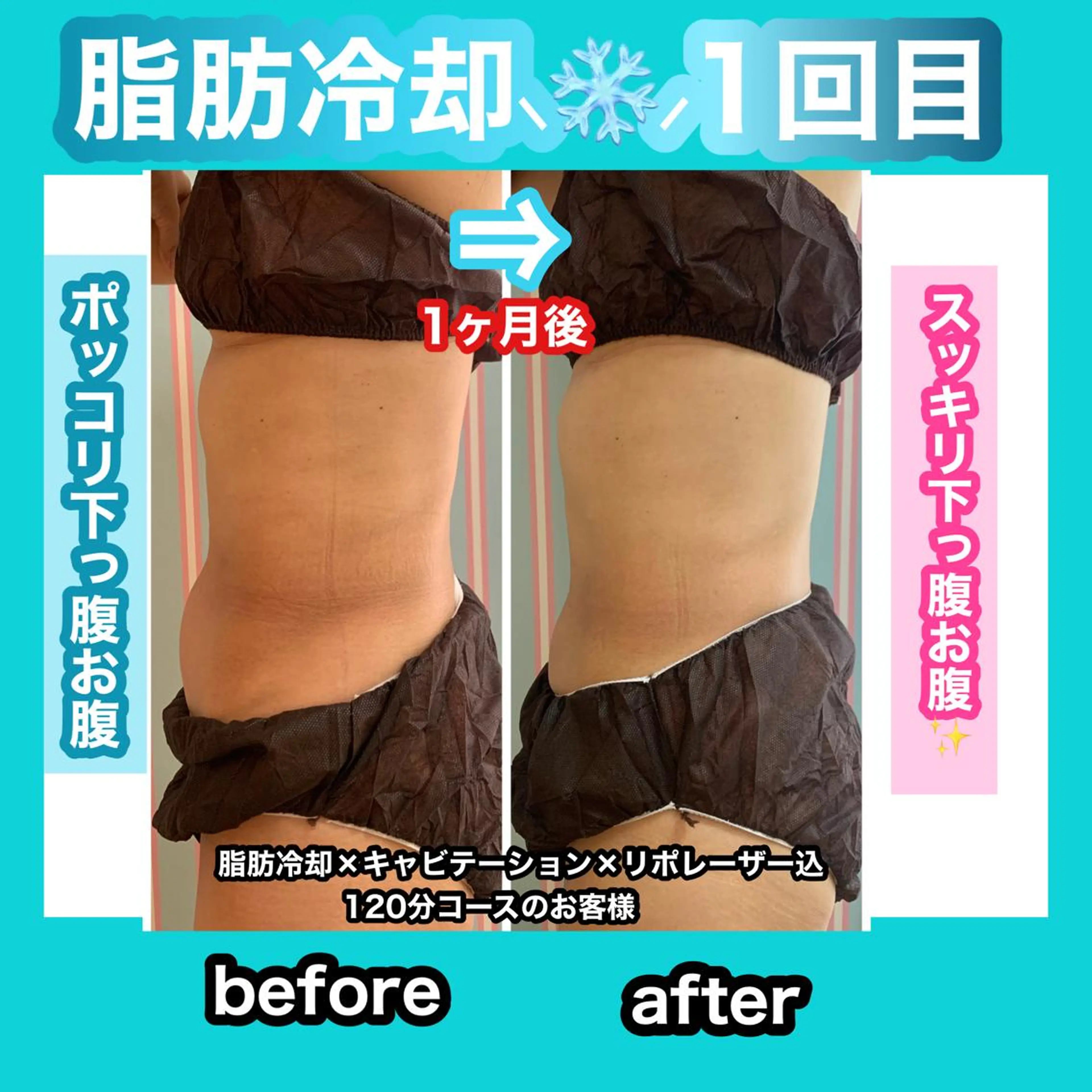 エステ 痩身/脱毛/ネイル HARUKAのエステ・リラクイメージ