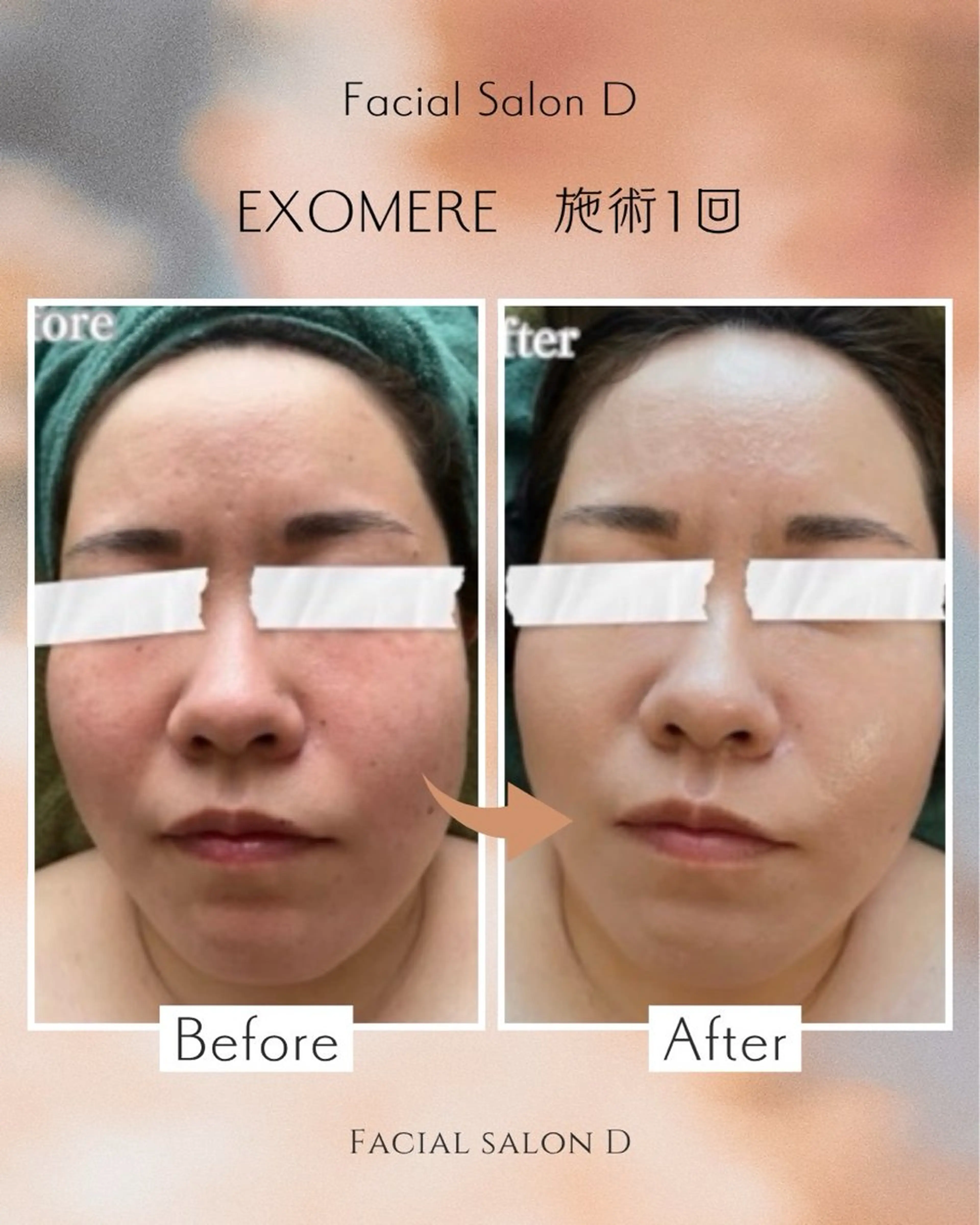 エステ リラク facial salon D 吉沢のエステ・リラクイメージ