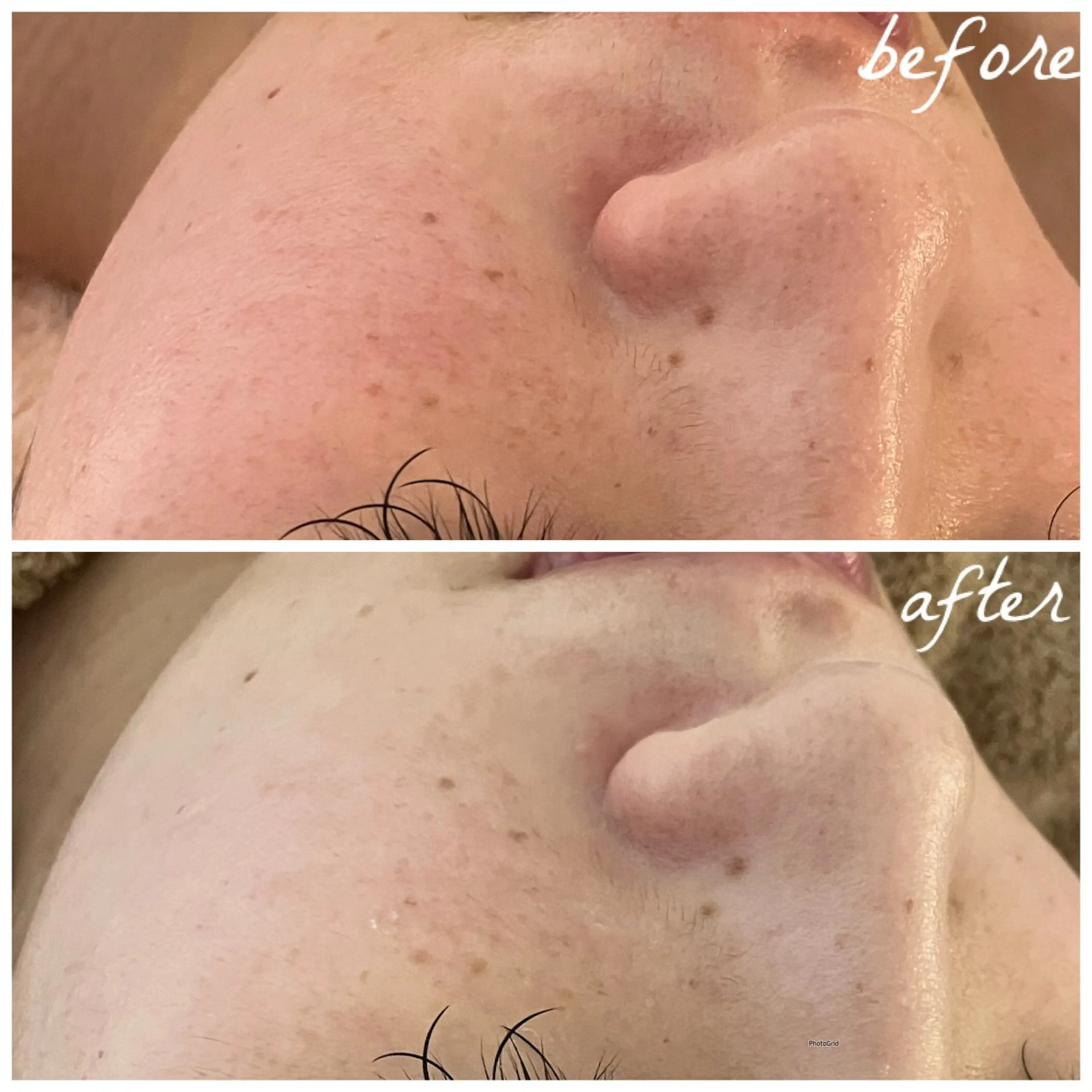 メンズ エステ メナード岐阜茜部 杉浦のエステ・リラクイメージ