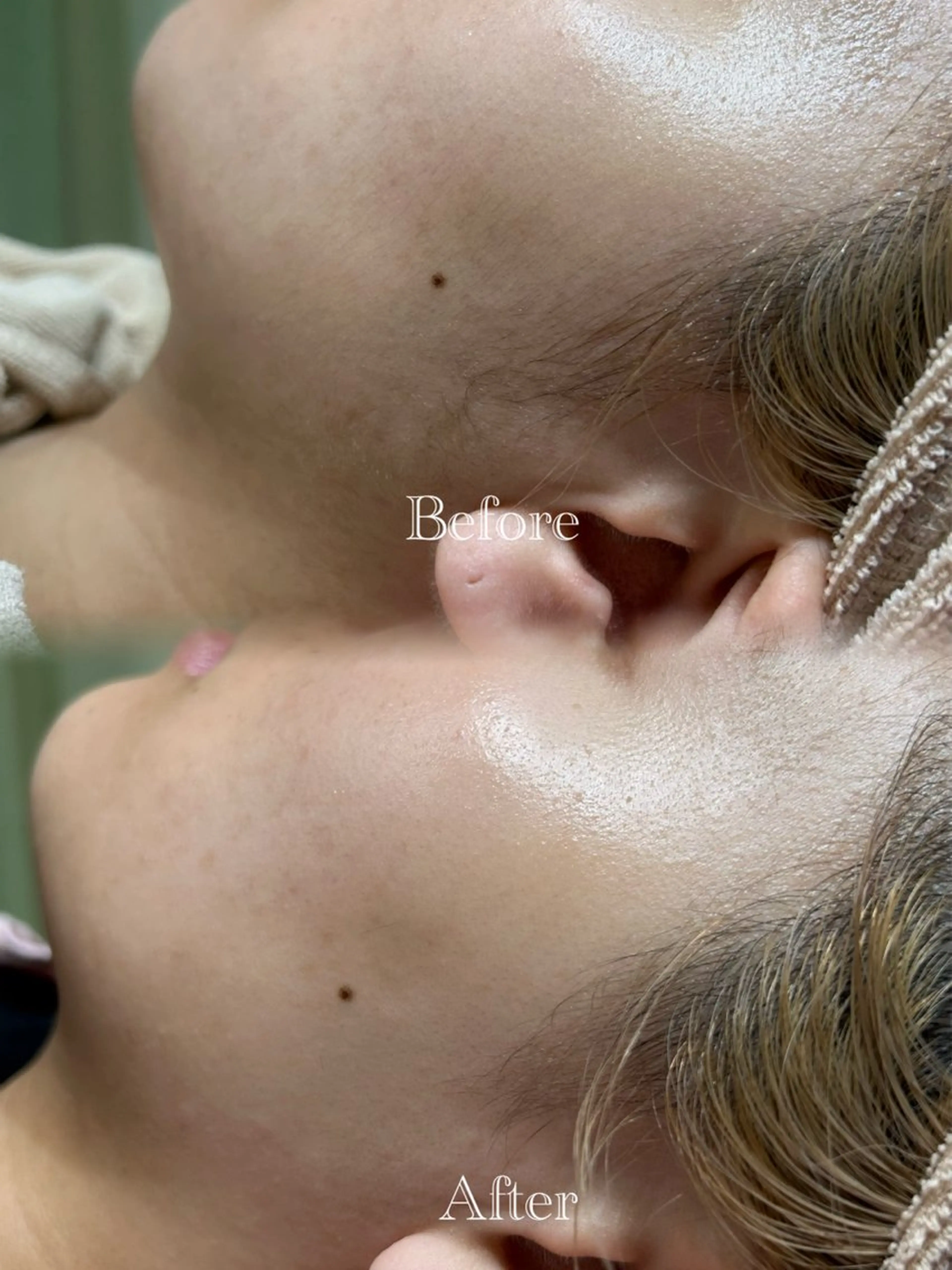 🫧美しい素肌へ🫧 今成柚乃のその他イメージ