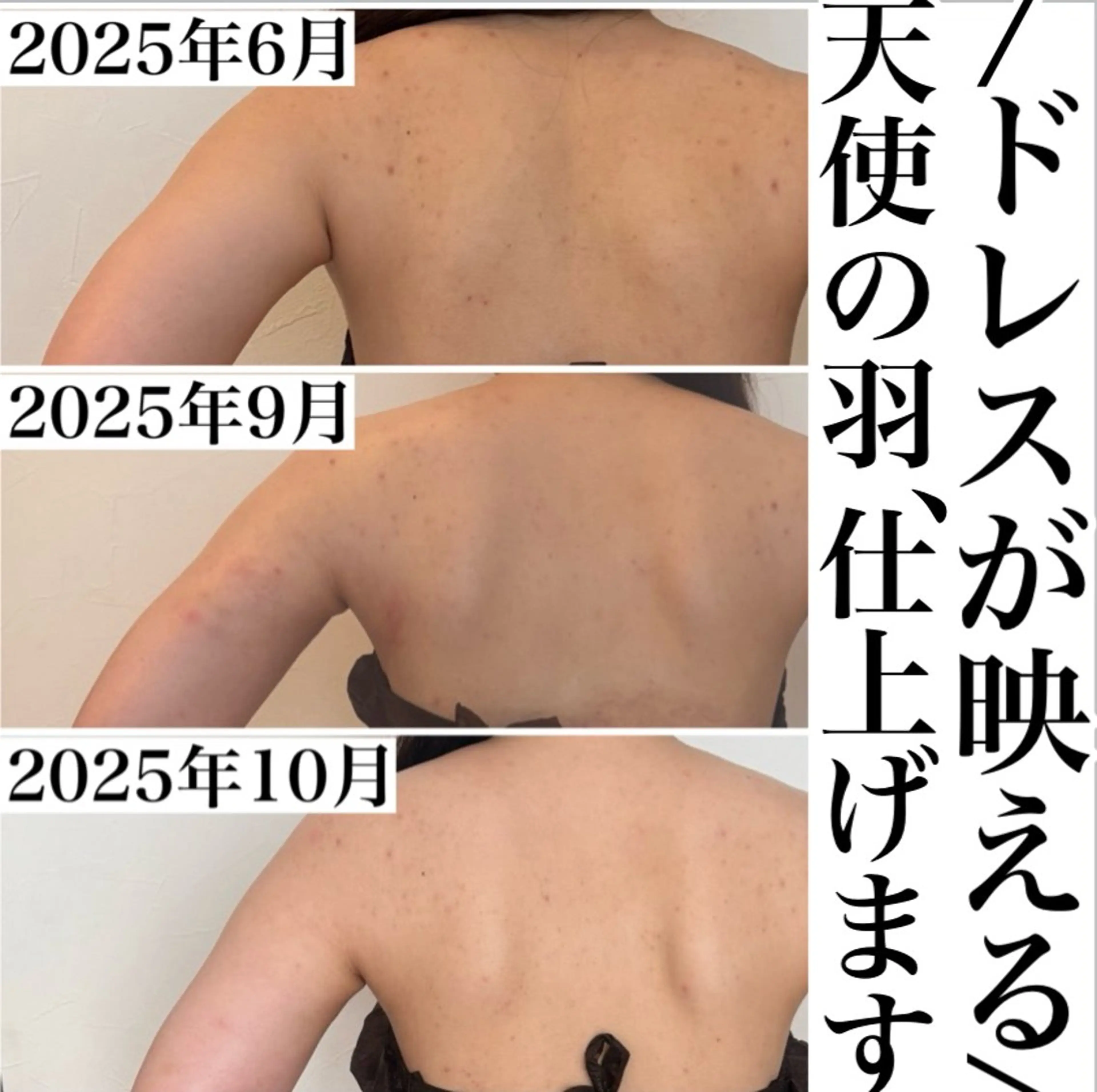 BEAUTY SALON BeLL所属・毛穴ケア専門店 BeLL ベルのエステ・リラクイメージ