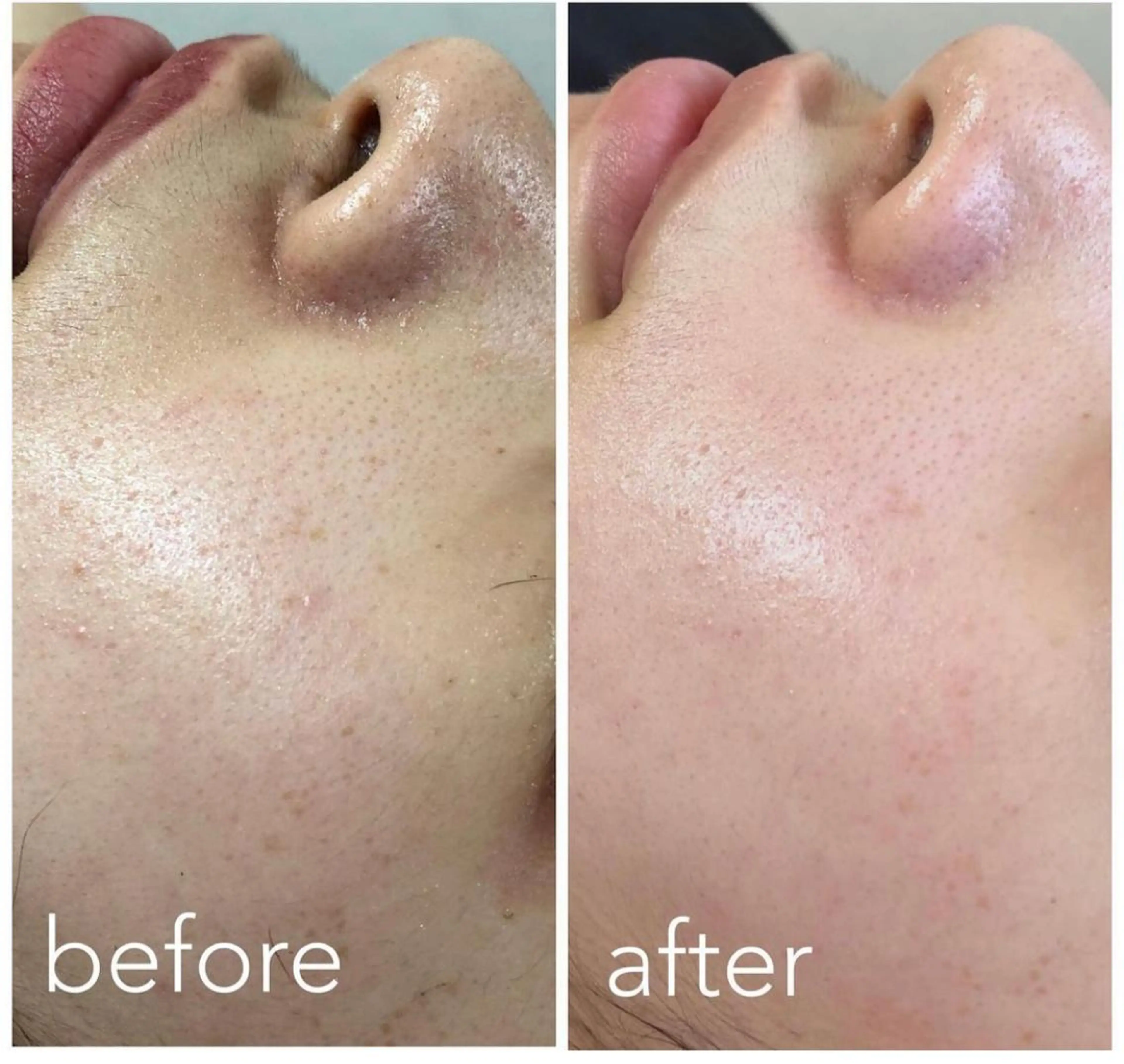 あだち整体エステ 首肩背中のゆるめぐのエステ・リラクイメージ