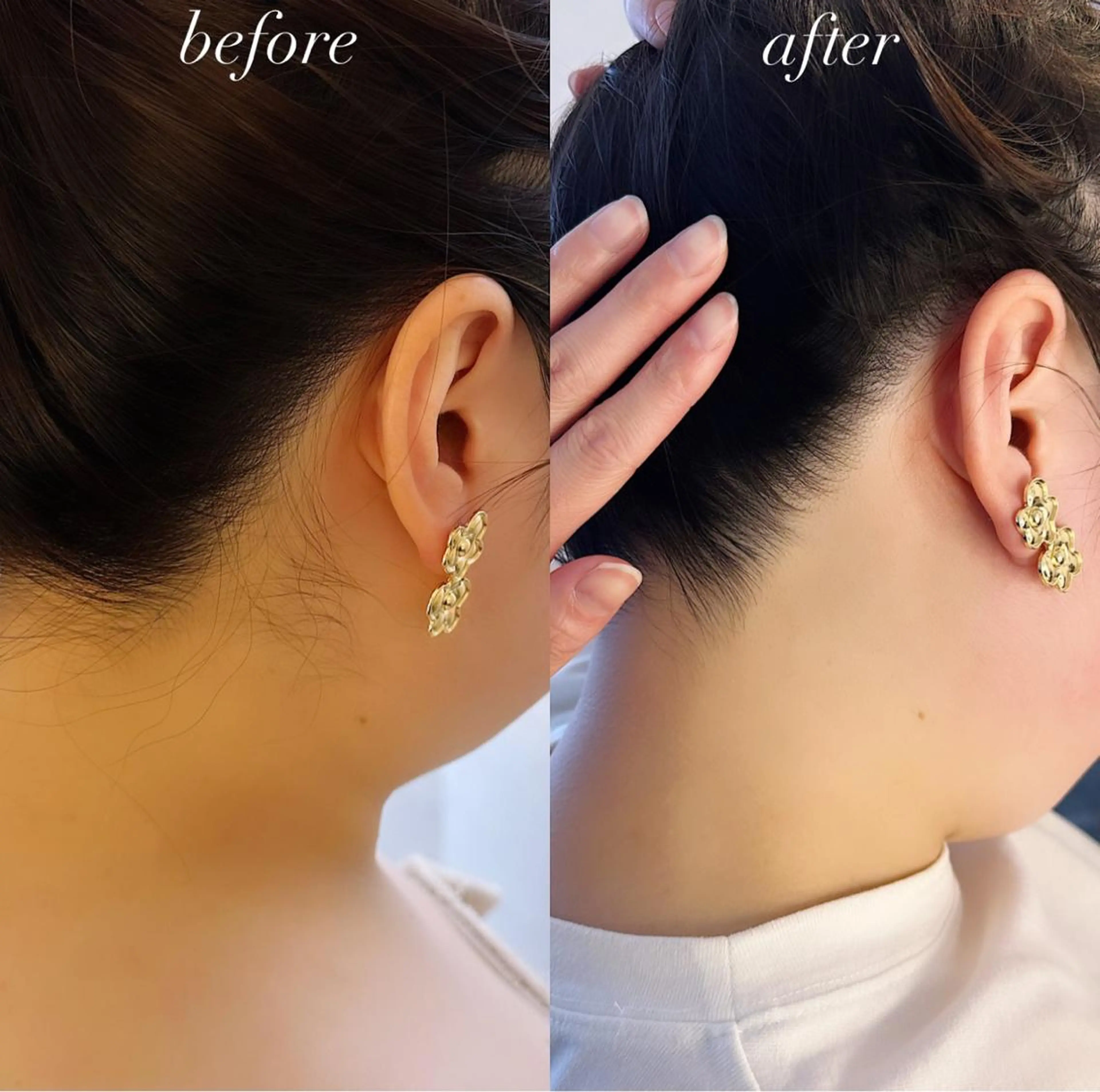 脱毛 うなじ脱毛/美肌脱毛 LABELのエステ・リラクイメージ