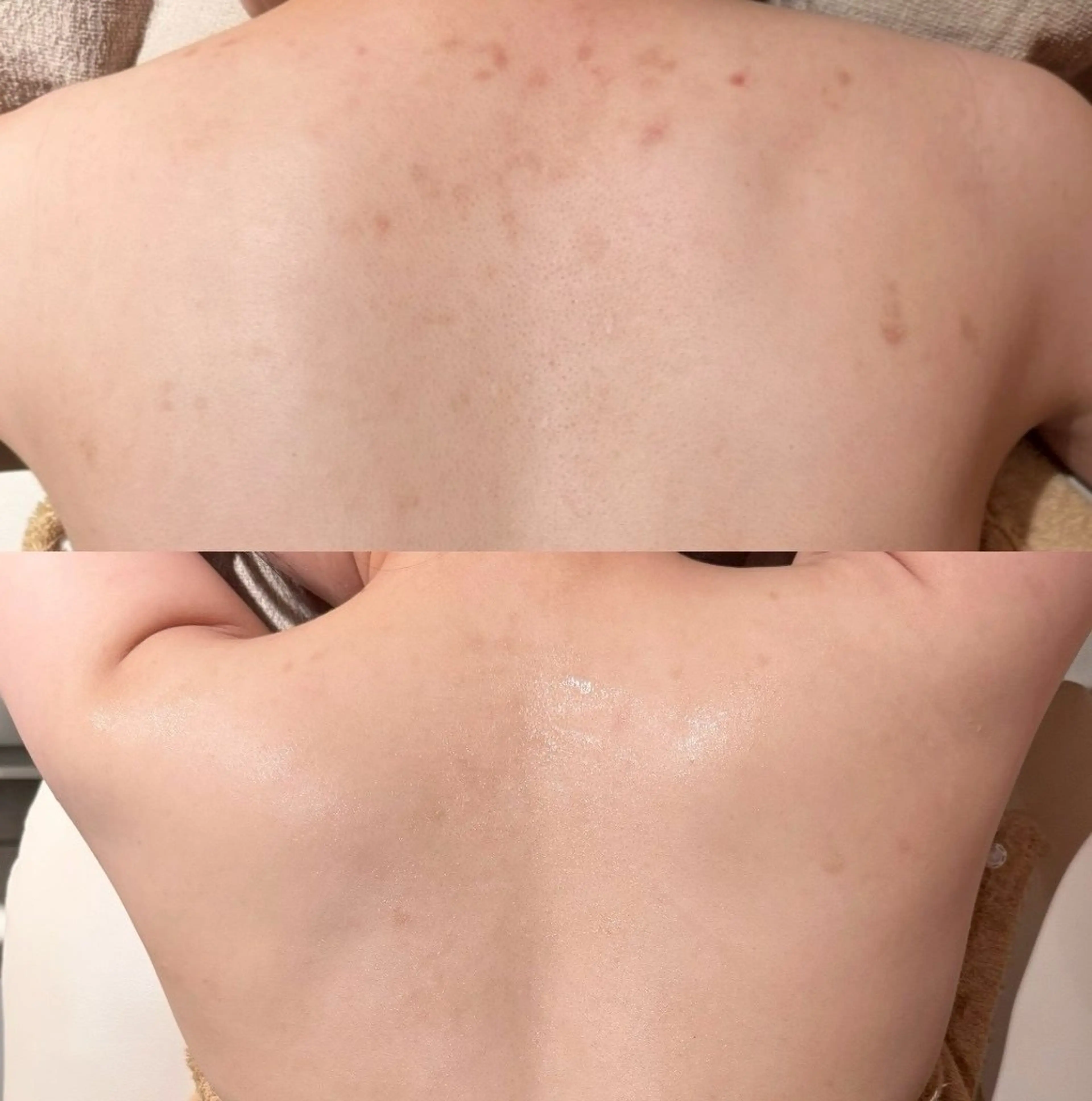 その他 for woman所属・森 美優のエステ・リラクイメージ