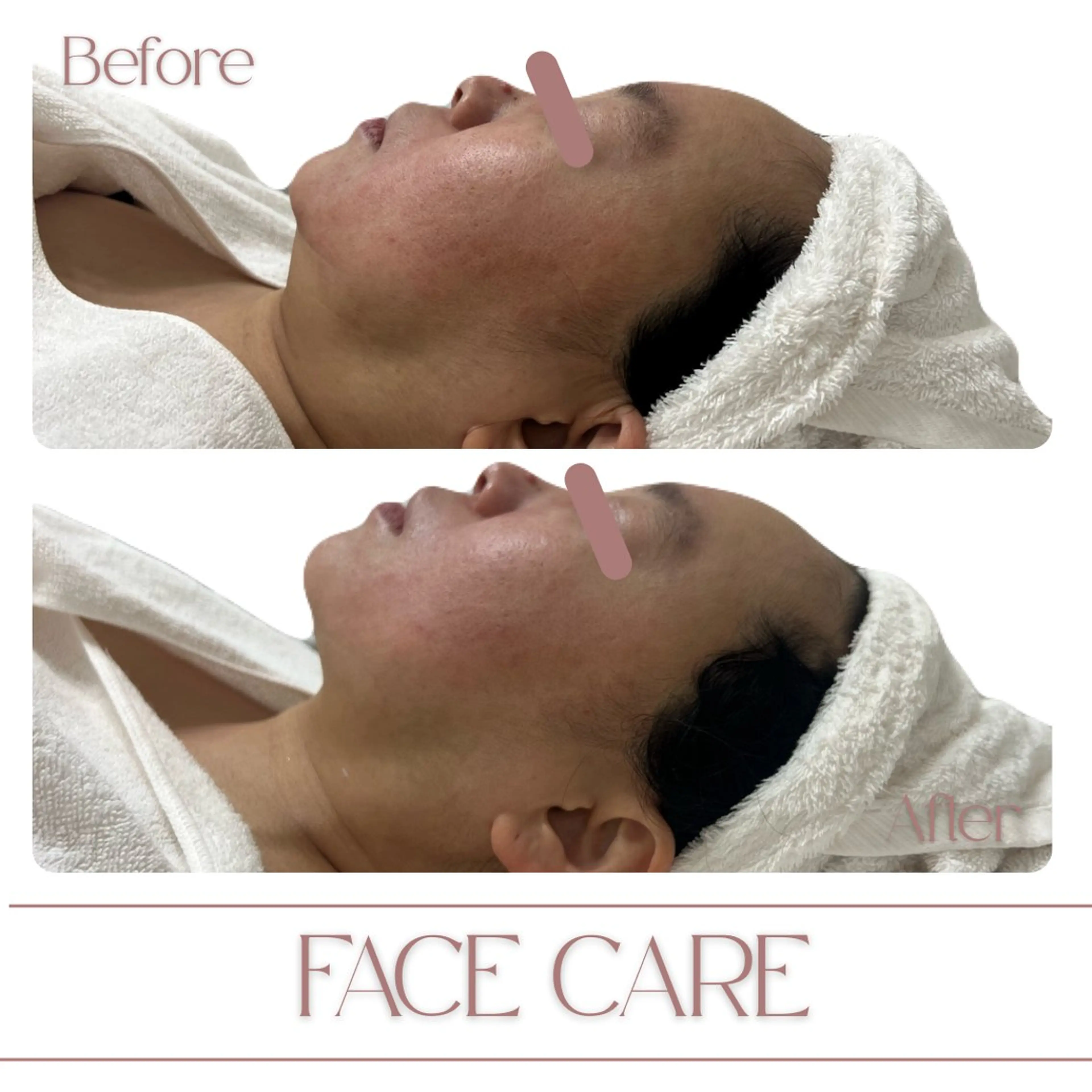 aimer 島田のエステ・リラクイメージ