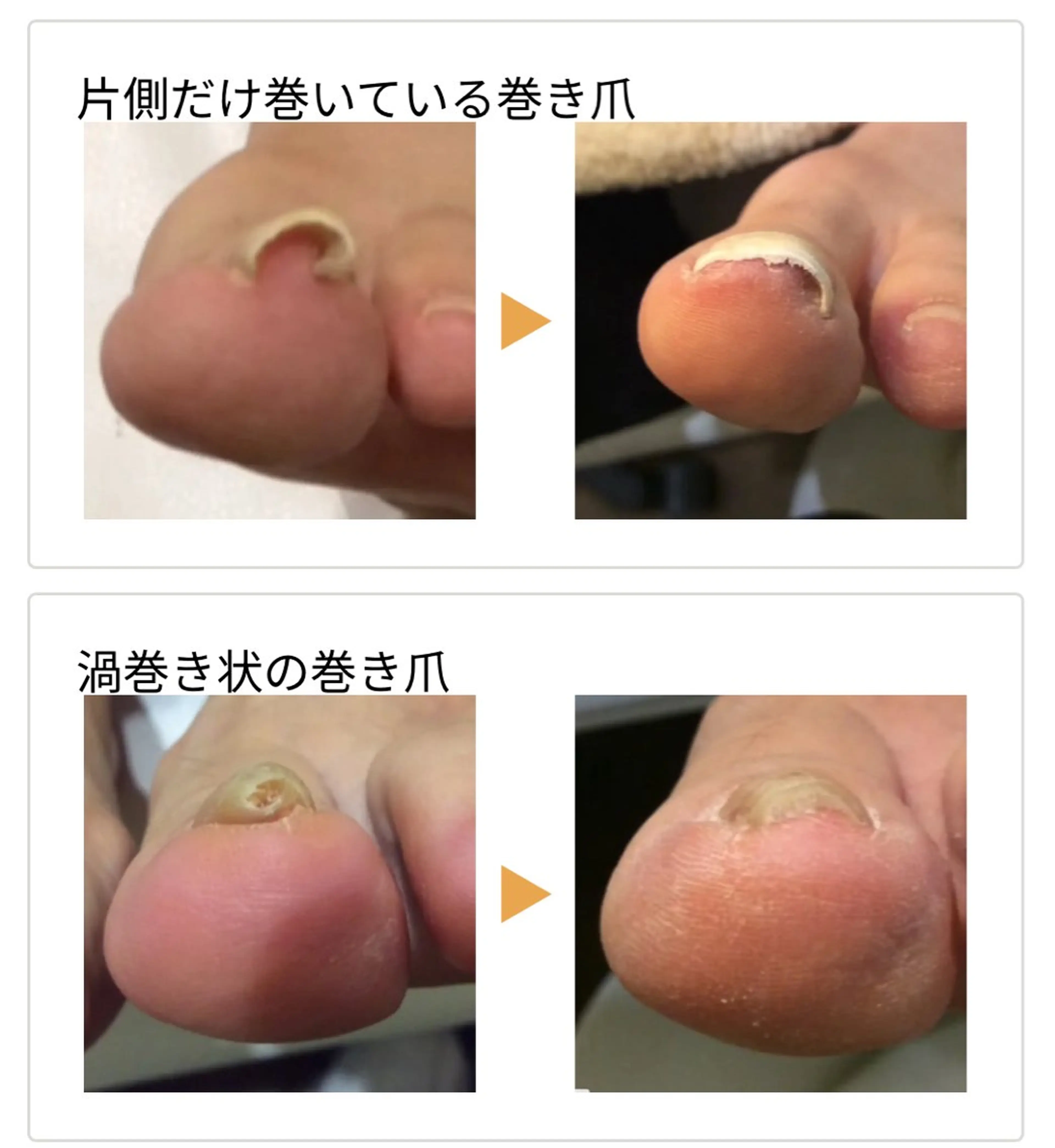 その他 日本巻き爪センター 渋谷院のエステ・リラクイメージ