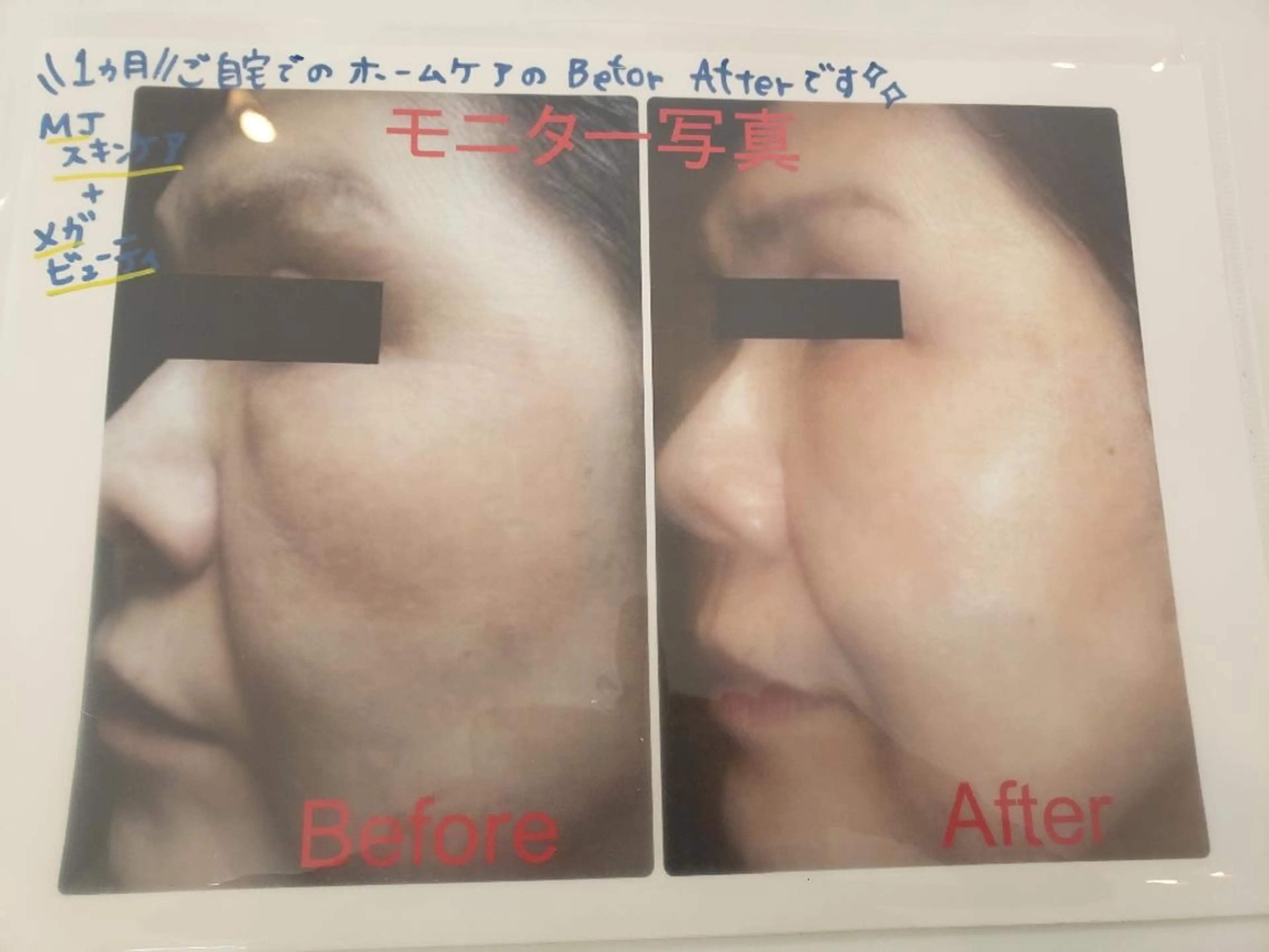 ユテラ 佑來（ゆき）のエステ・リラクイメージ