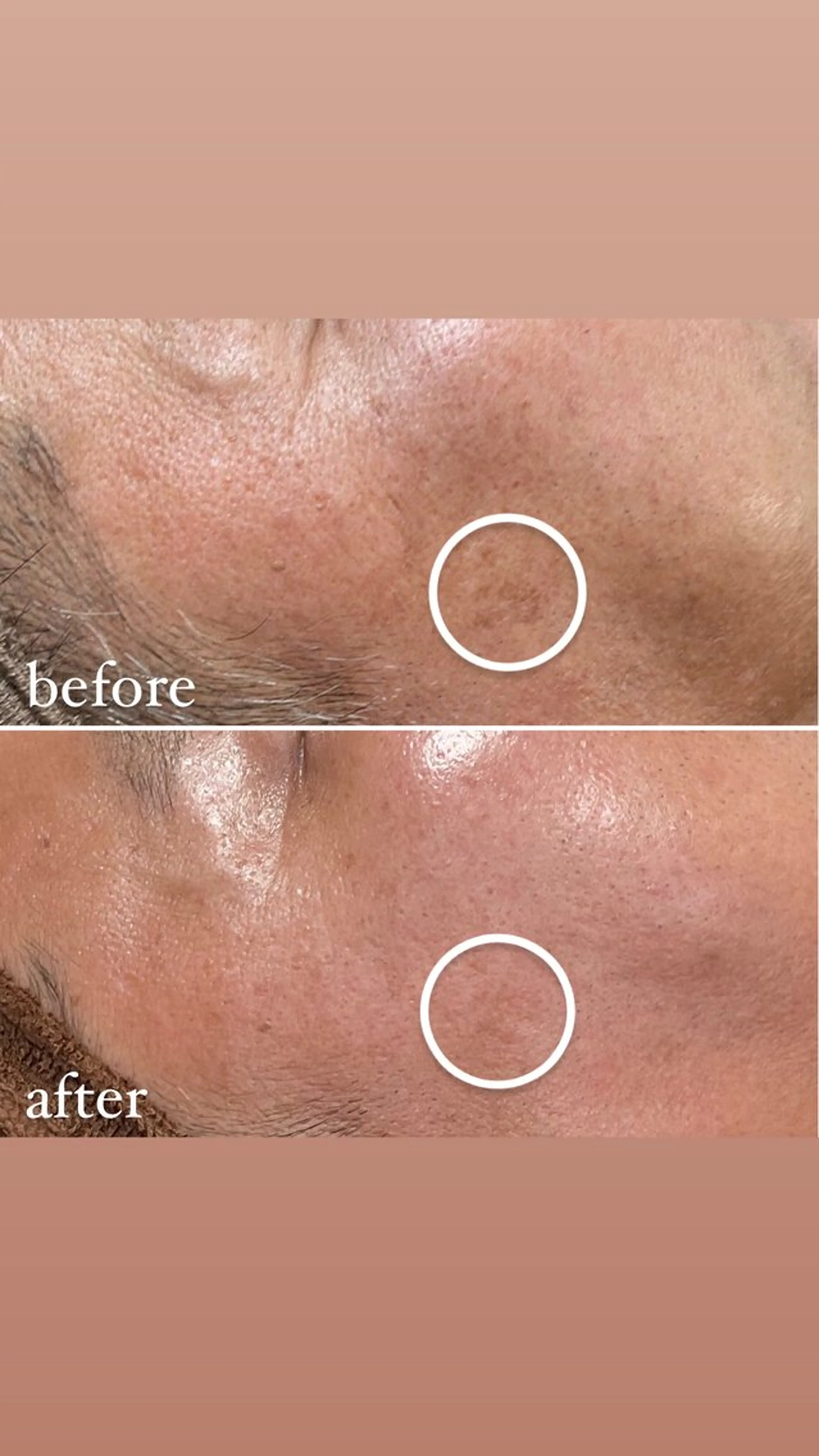 brilliance所属・老化肌トラブル肌専門 Brillianceのエステ・リラクイメージ