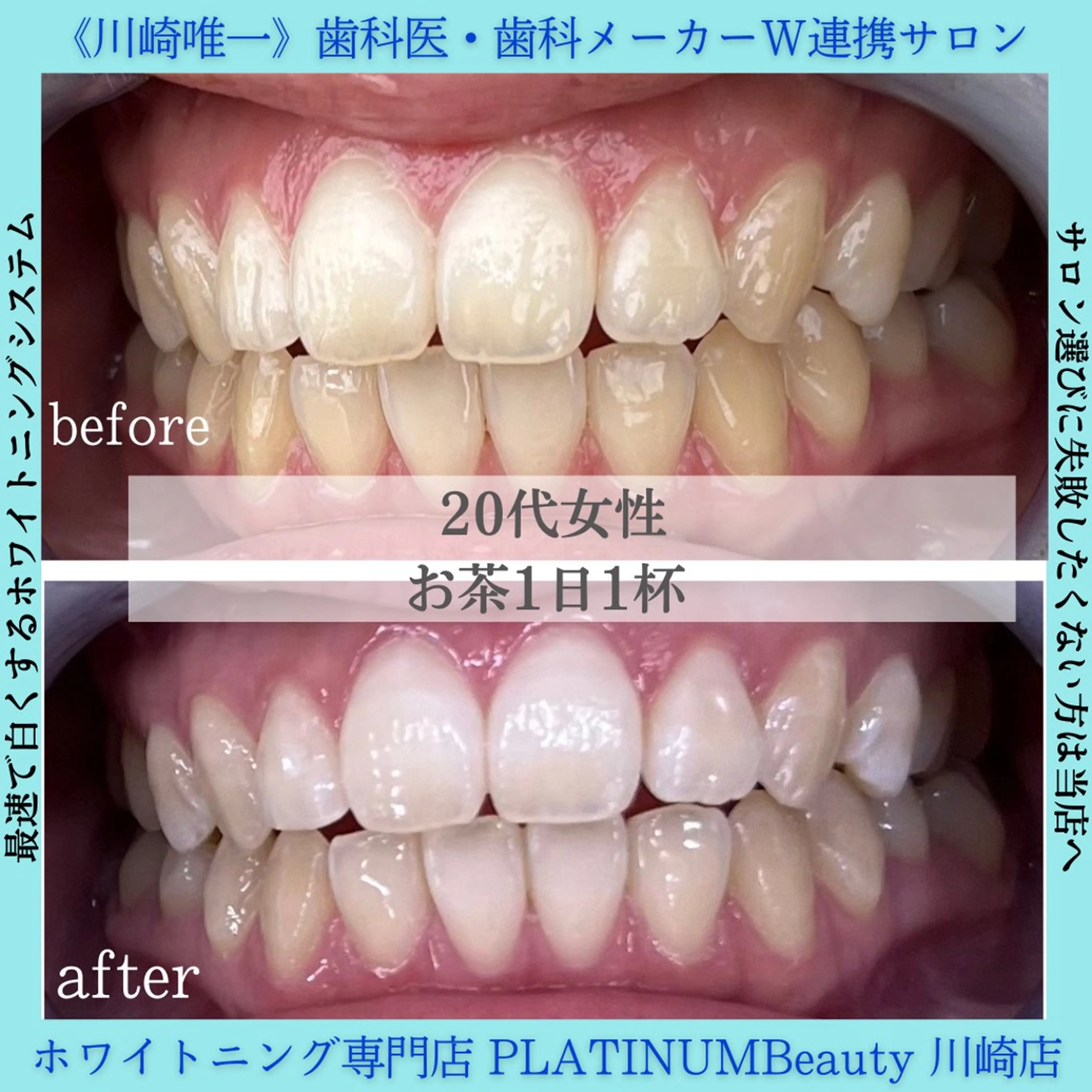 PLATINUM Beauty 川崎店のエステ・リラクイメージ