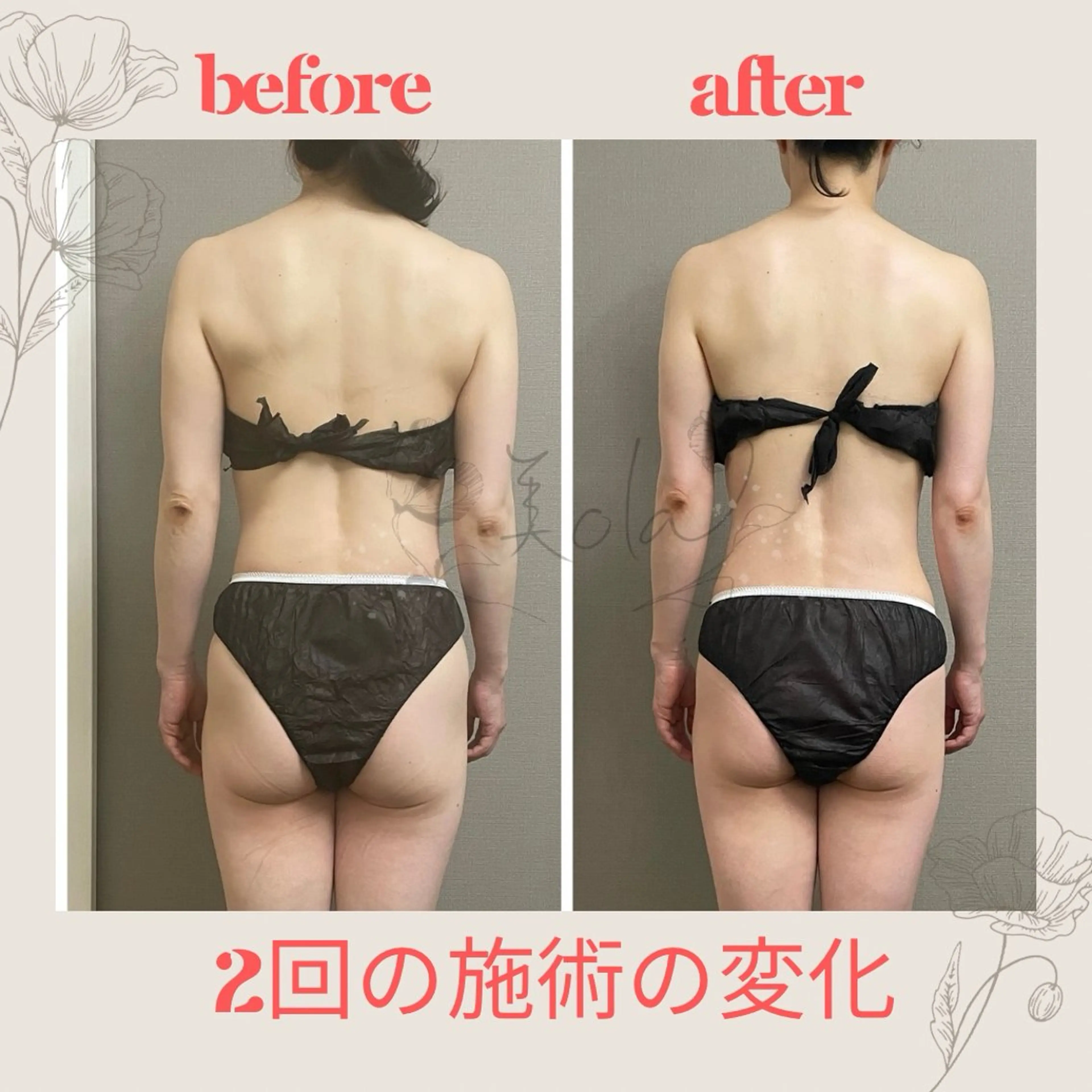 エステ リラク 美ola ビオラのエステ・リラクイメージ