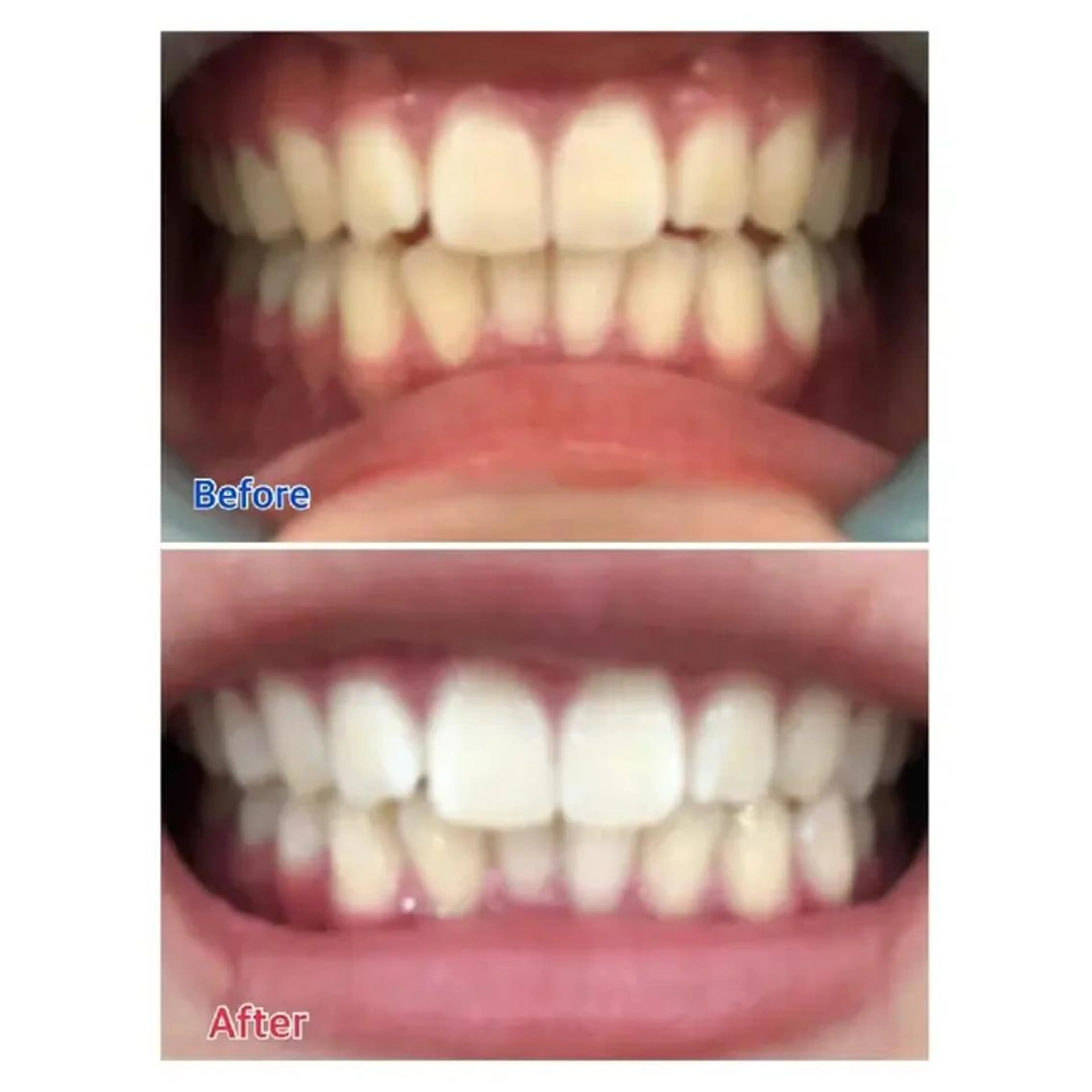 M渋谷 ホワイトニングのエステ・リラクイメージ